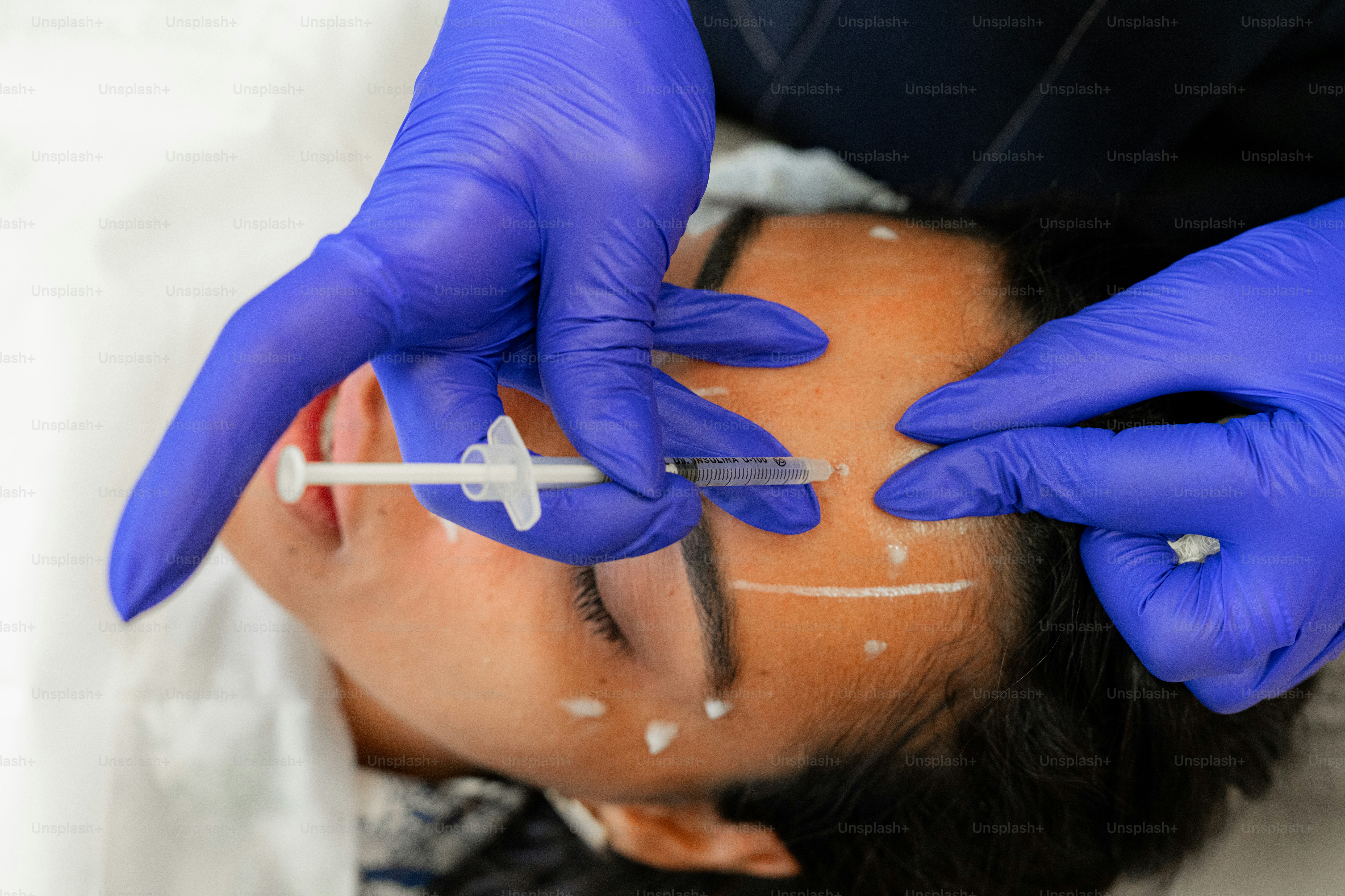 A man getting his forehead examined by a doctor