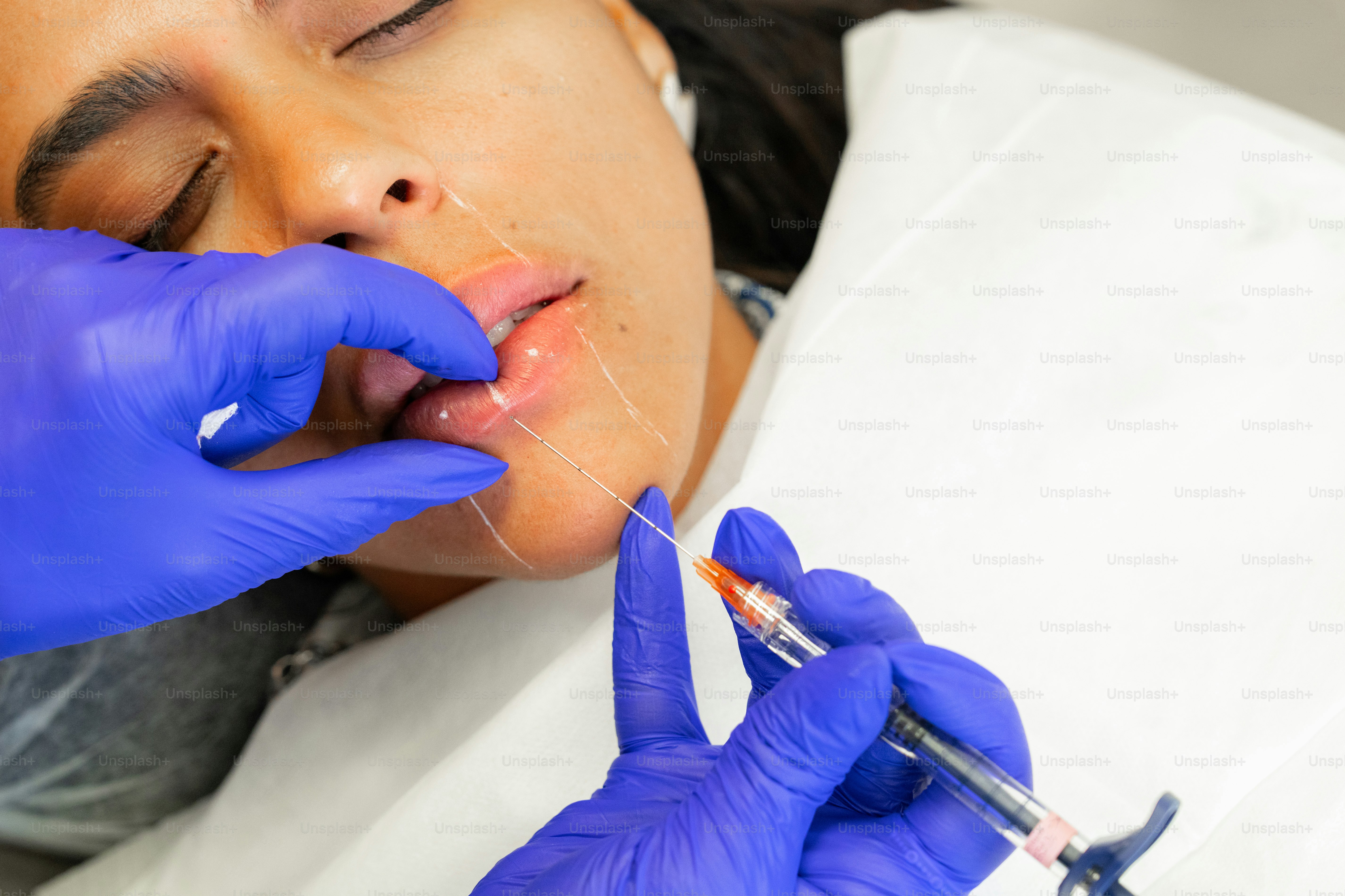 A woman getting her teeth checked by a dentist