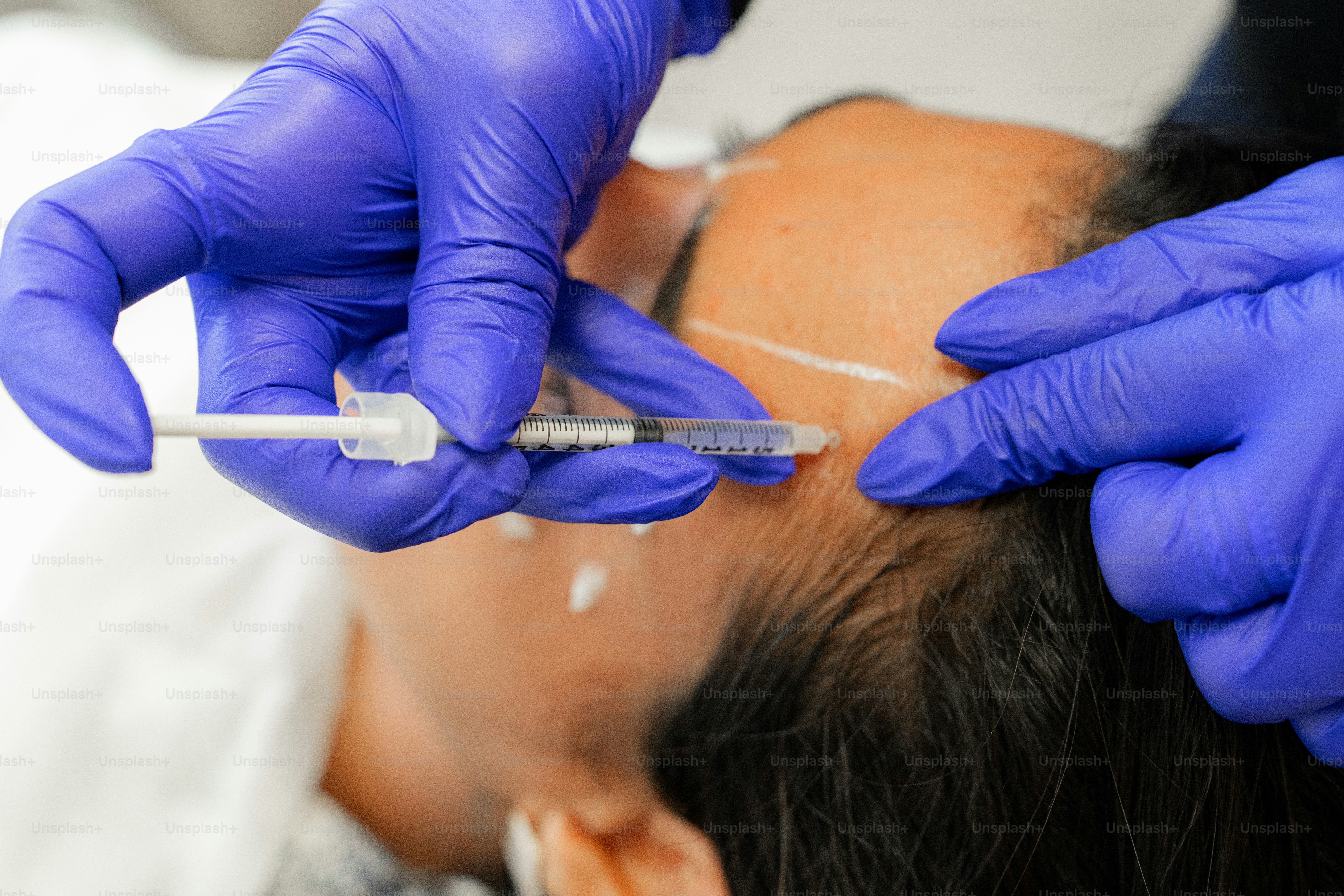 A man getting his teeth checked by a dentist