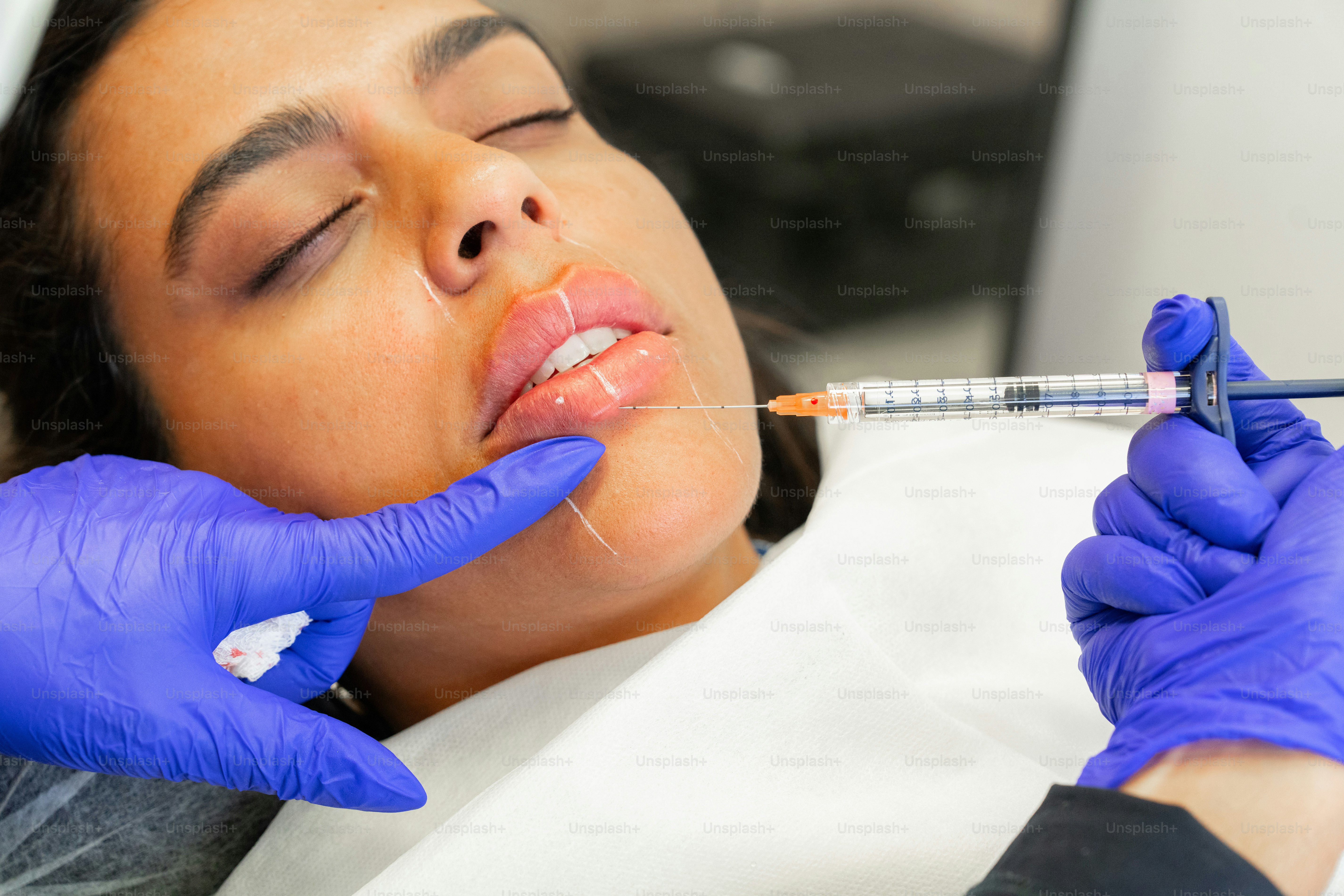 A woman getting her teeth checked by a dentist