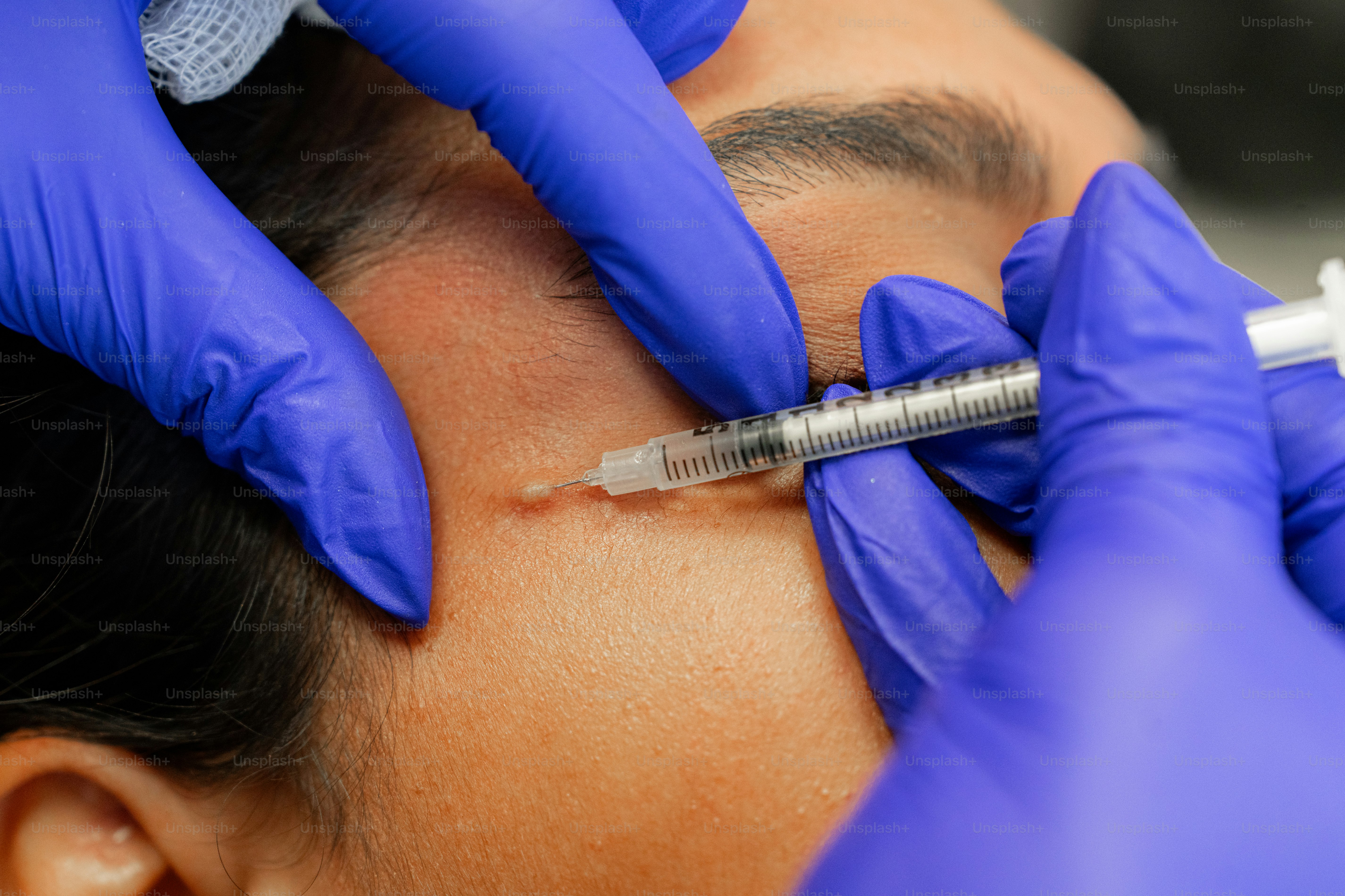A woman getting her eyebrows examined by a doctor