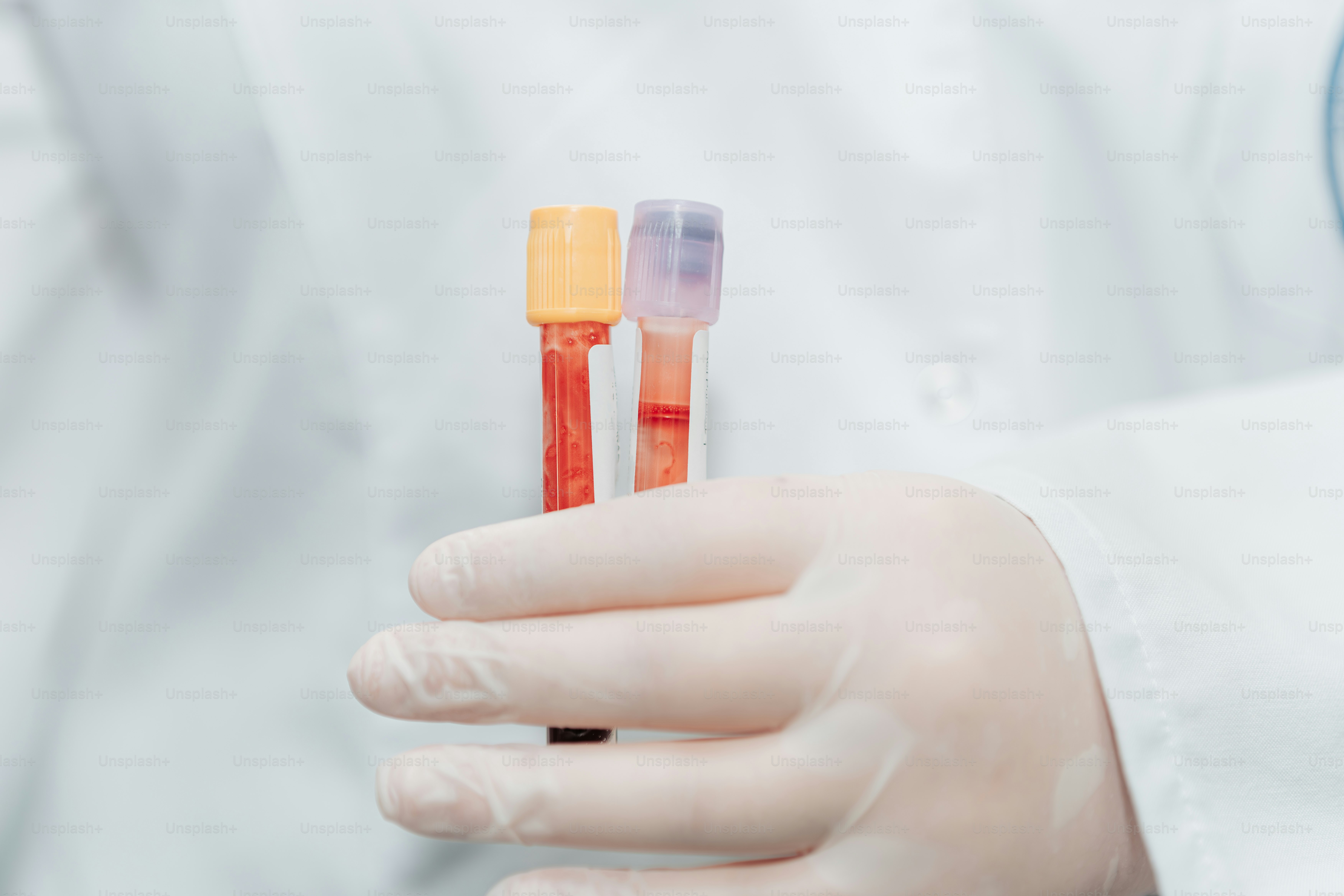 A person in a lab coat holding two test tubes