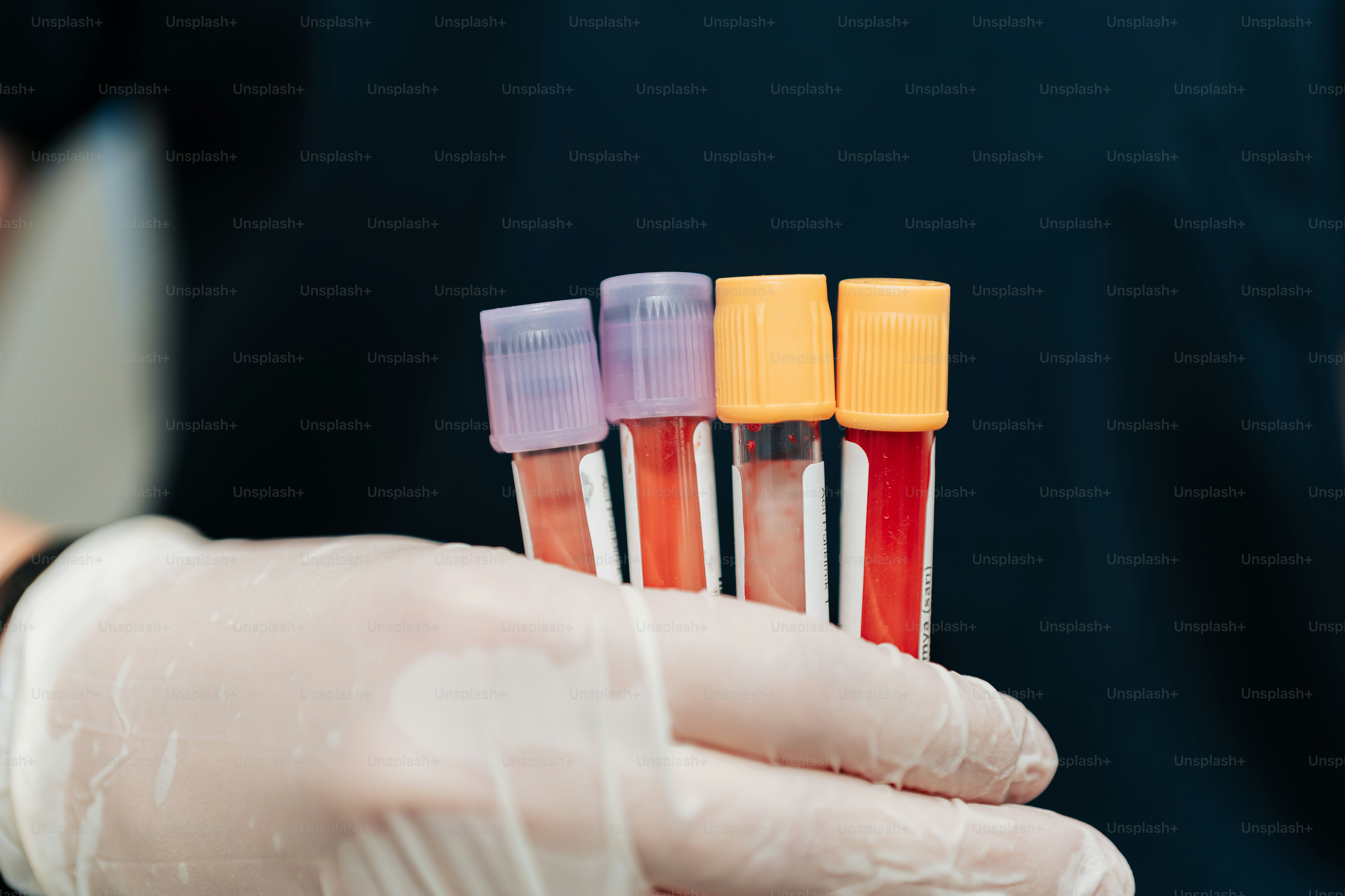 흰 장갑을 낀 사람이 시험관을 한 줄로 들고 있다