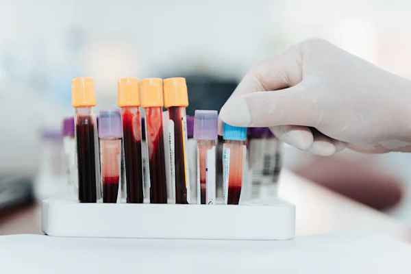 Professional Phlebotomist Home Visit