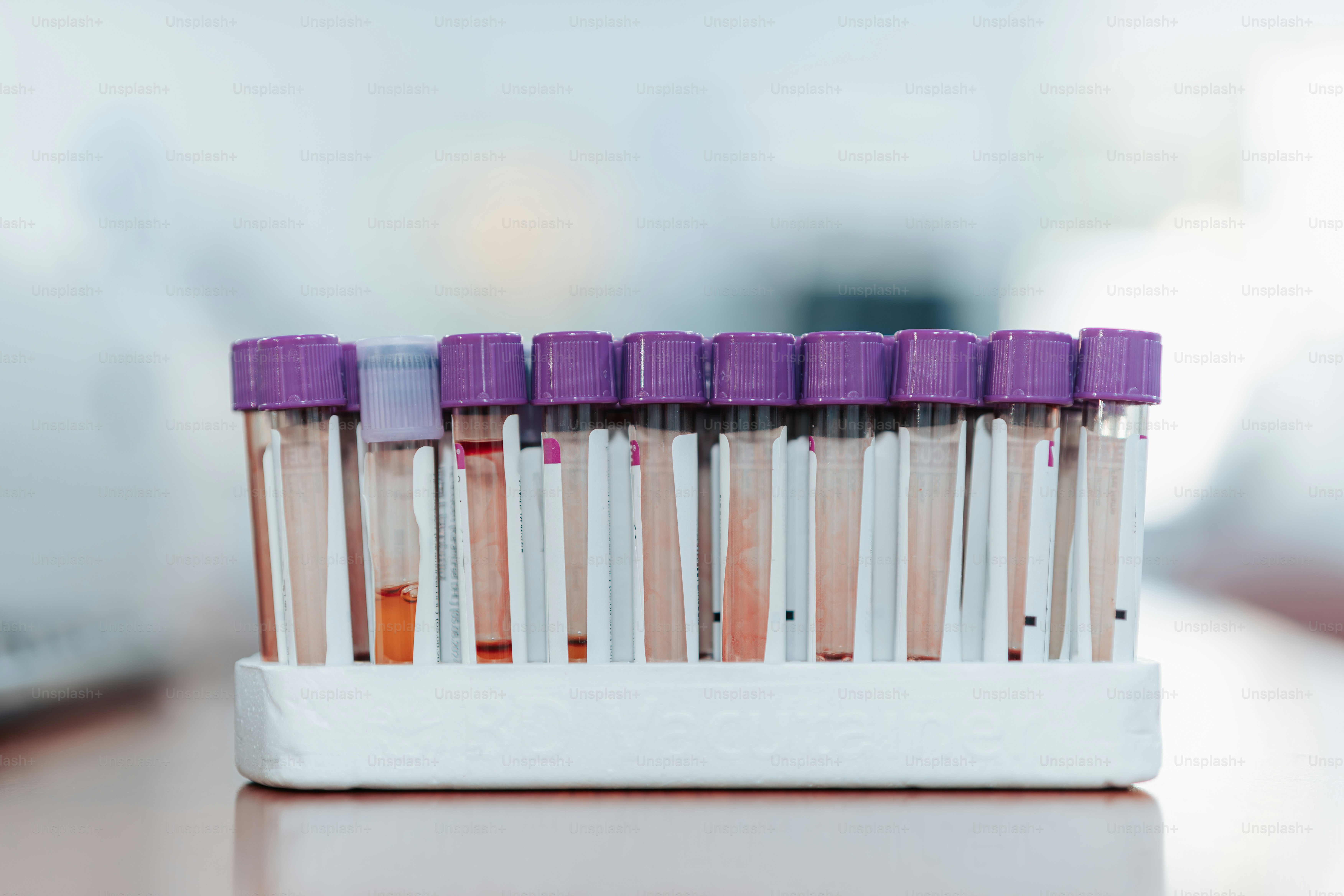 A row of test tubes sitting on top of a table