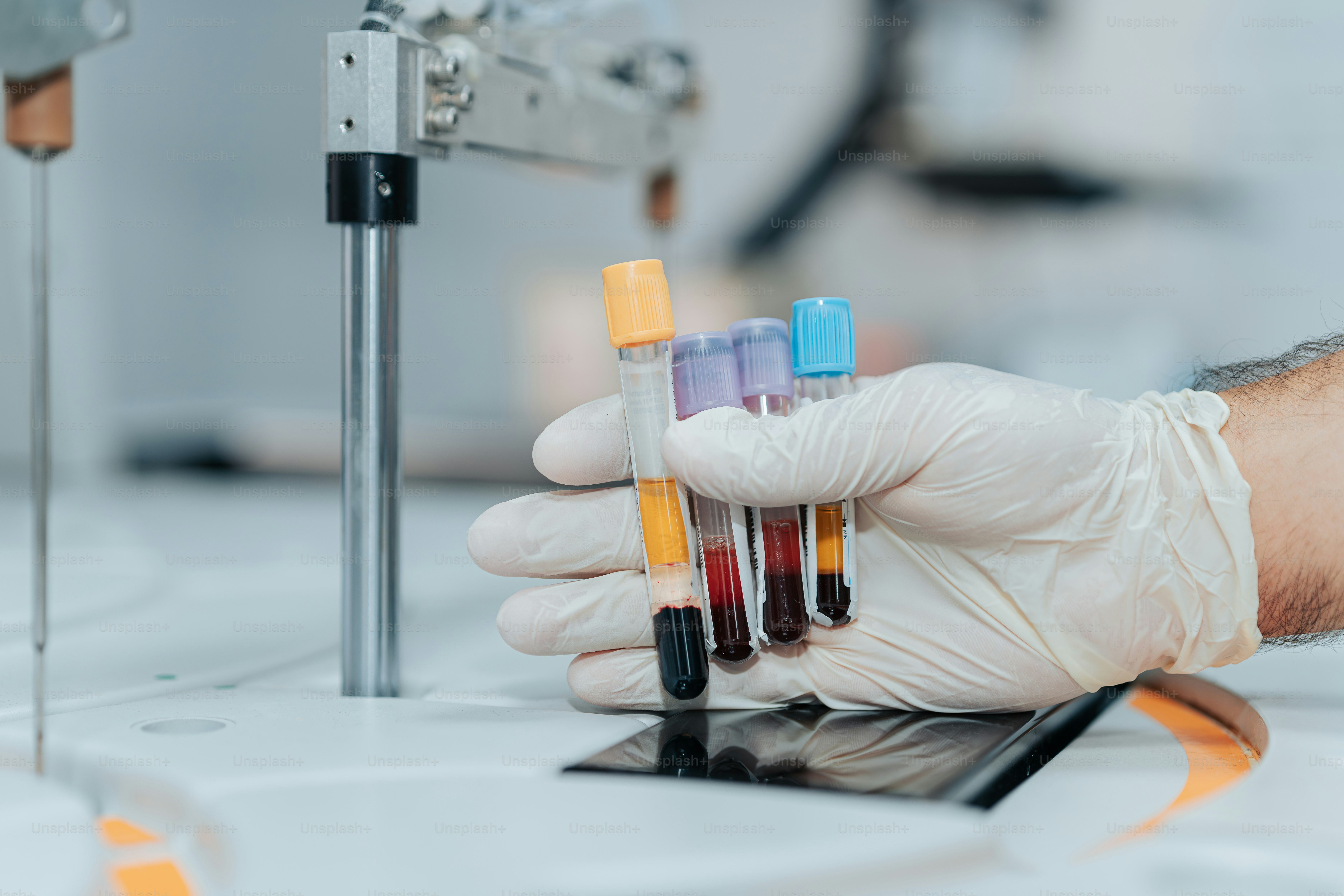 Una persona con guantes blancos sostiene un tubo de ensayo