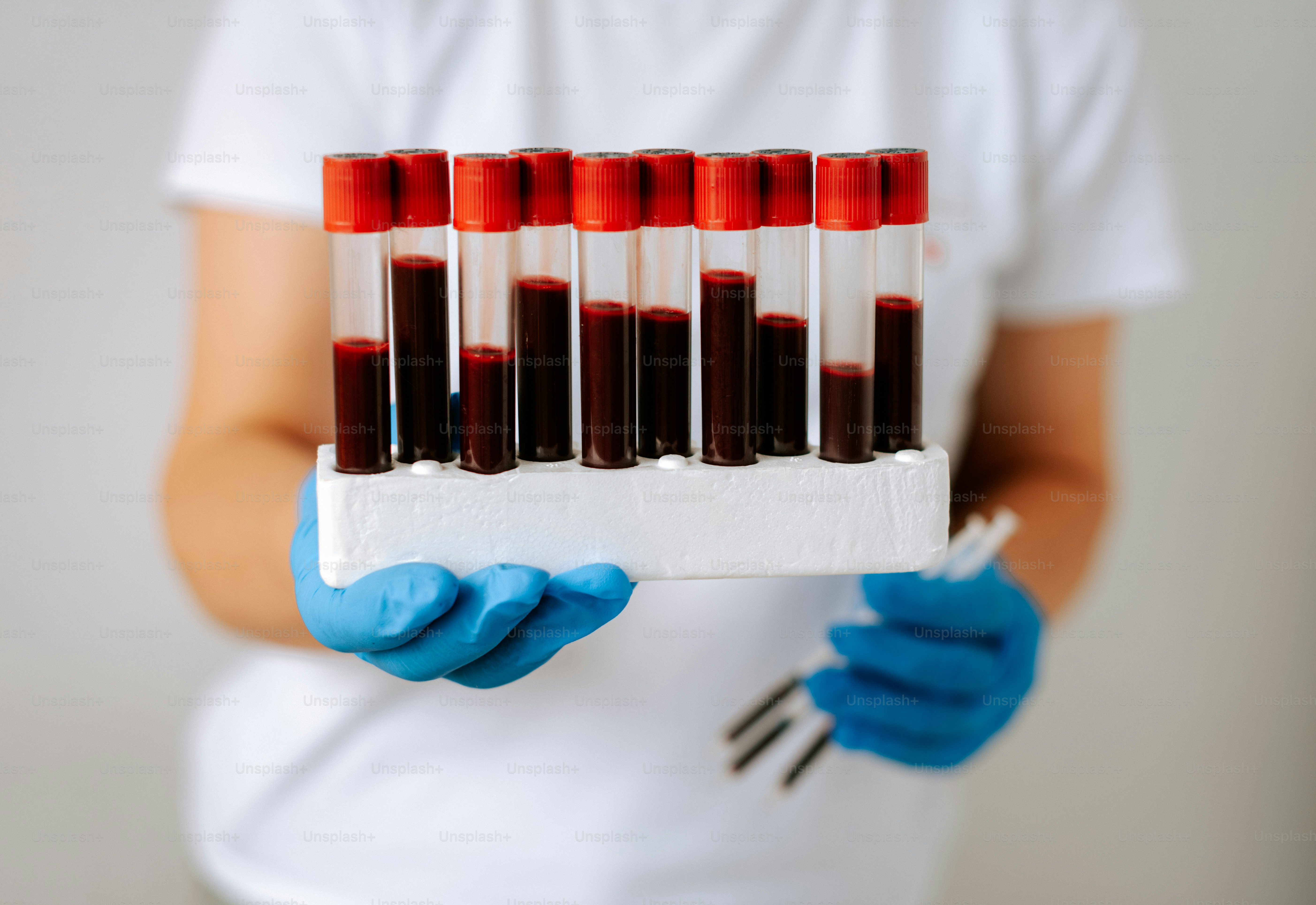 Eine Person in blauen Handschuhen, die ein Tablett mit Reagenzgläsern hält