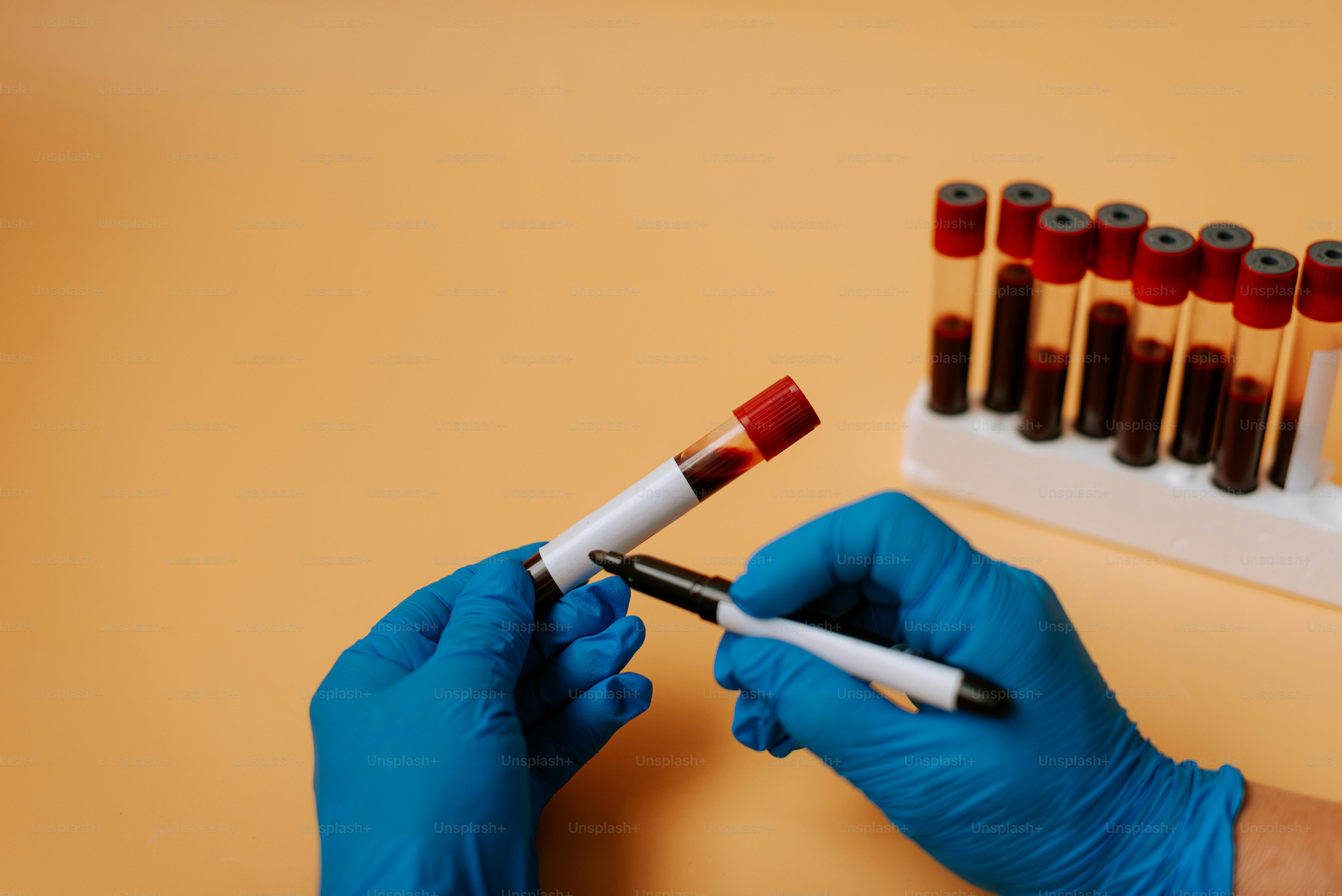 Eine Person in blauen Handschuhen, die ein Röhrchen mit Blut hält