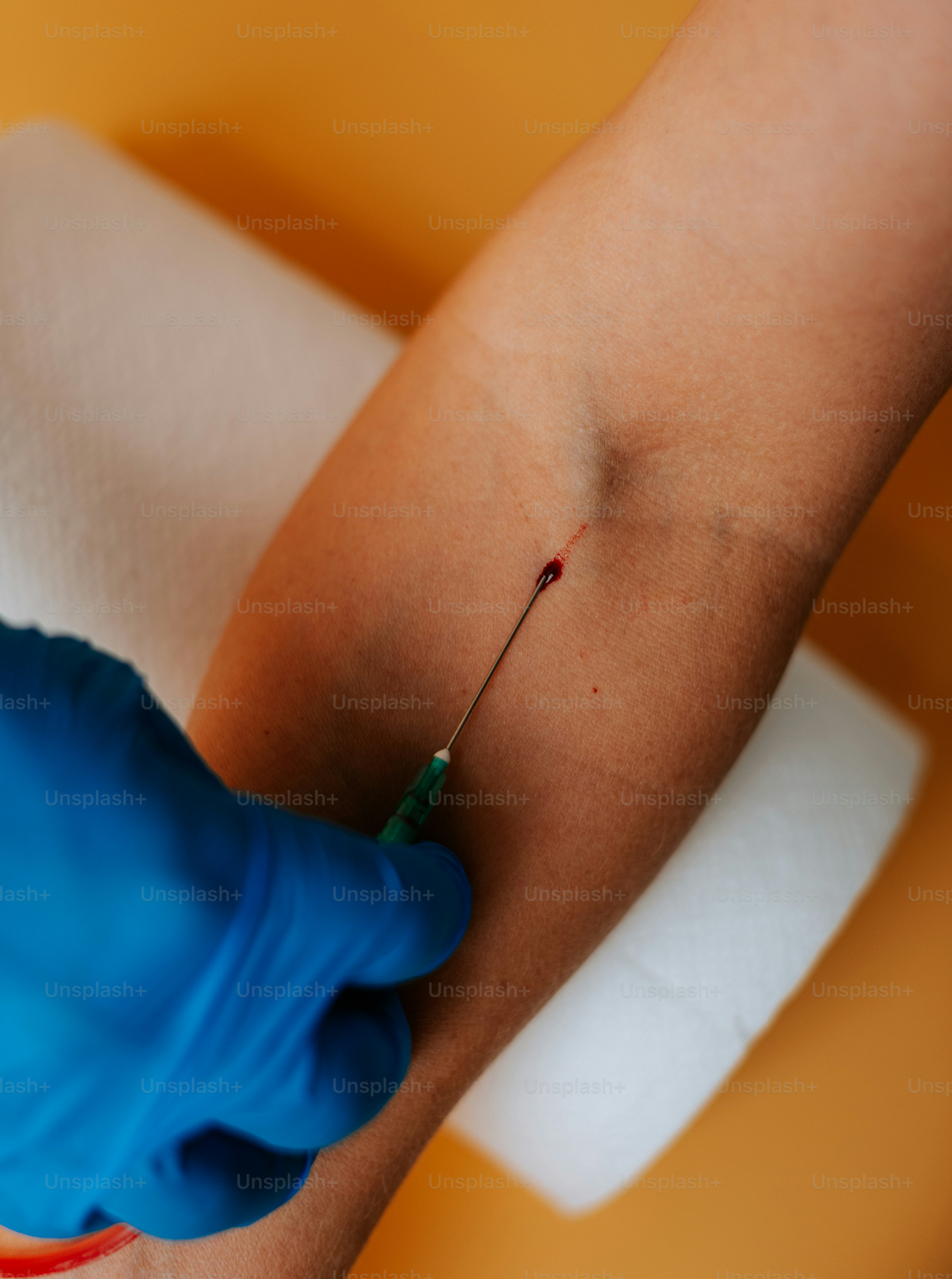 A person with a blue glove and a needle in their arm