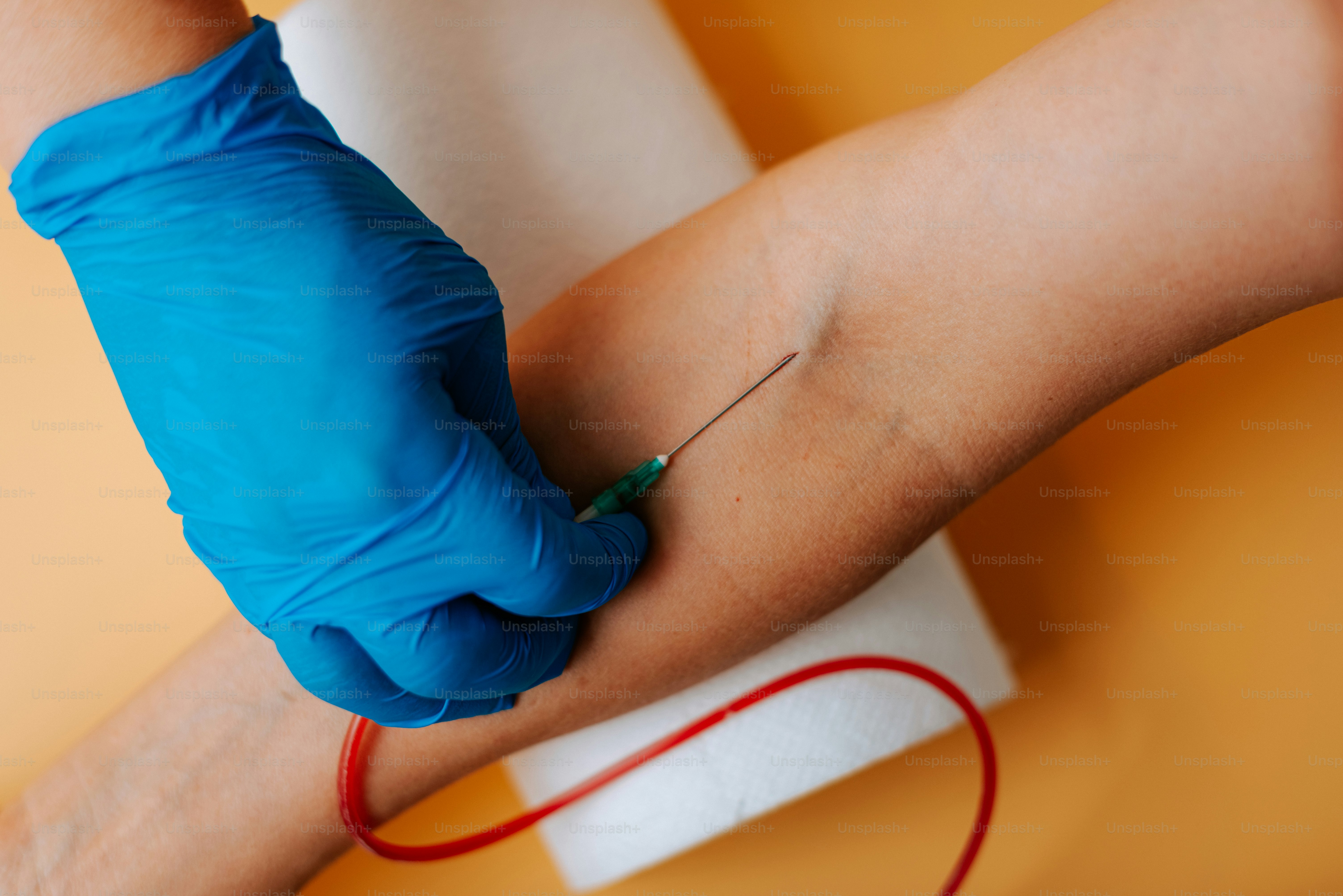 Picada de agulha foto de stock. Imagem de morena, ajuda - 14901908, image size:3000x2003