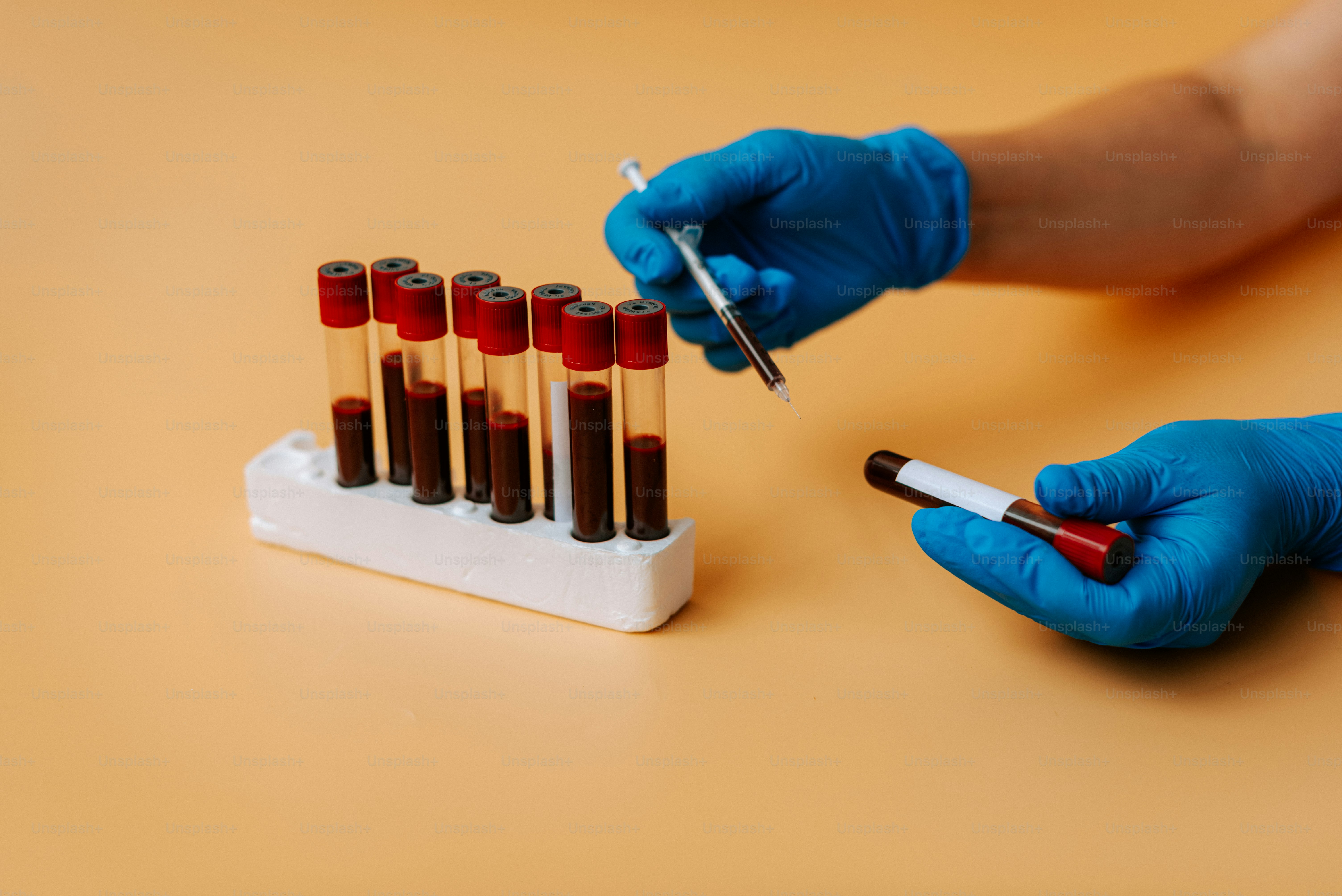 Eine Person mit blauen Handschuhen hält einen Stift und einen Satz Reagenzgläser in der Hand