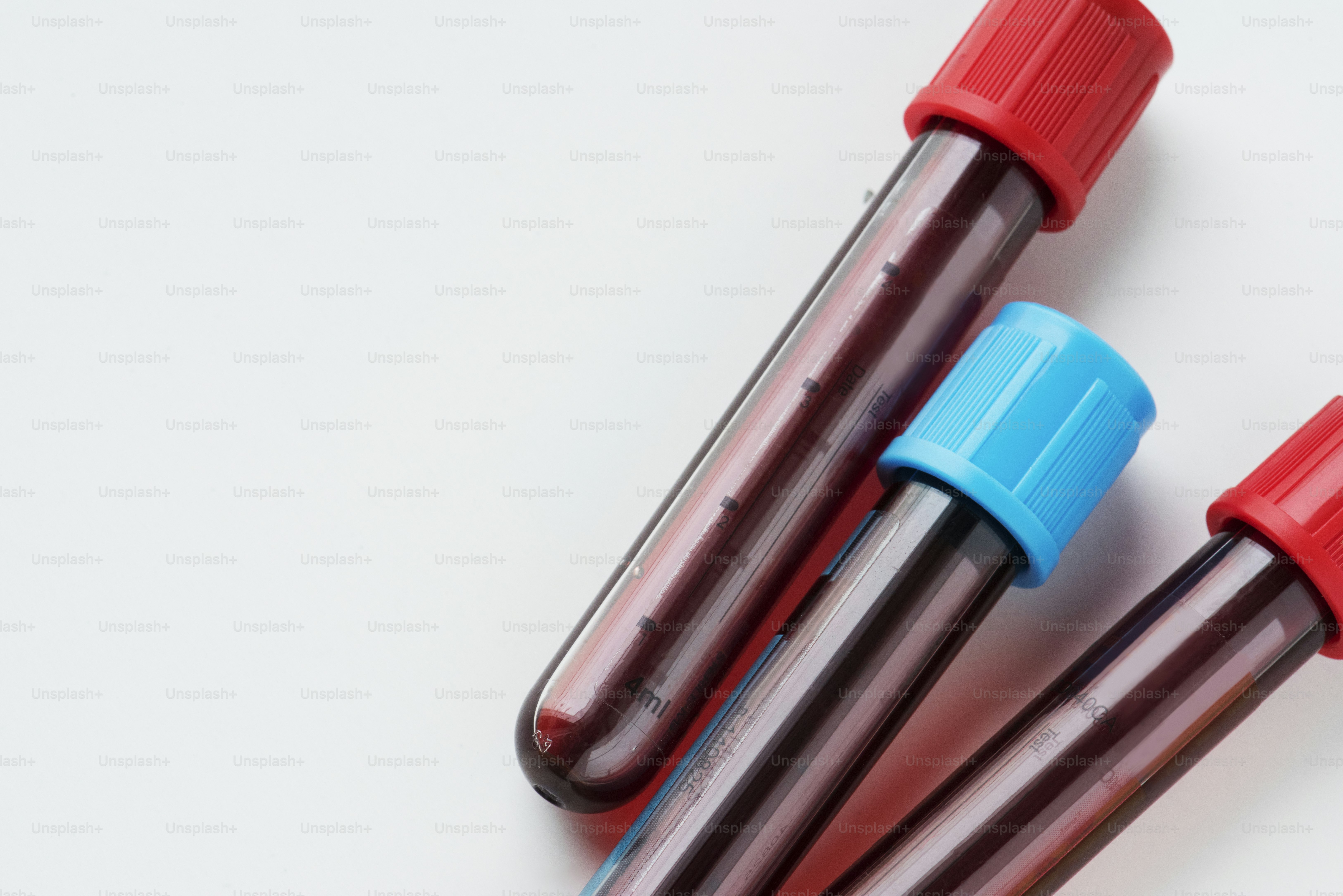 Gros plan du test du tube sanguin