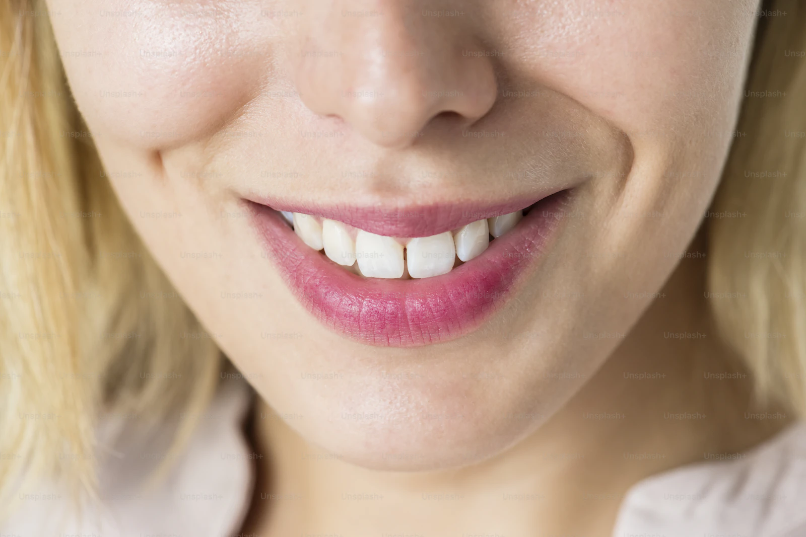Orthodontic before and after