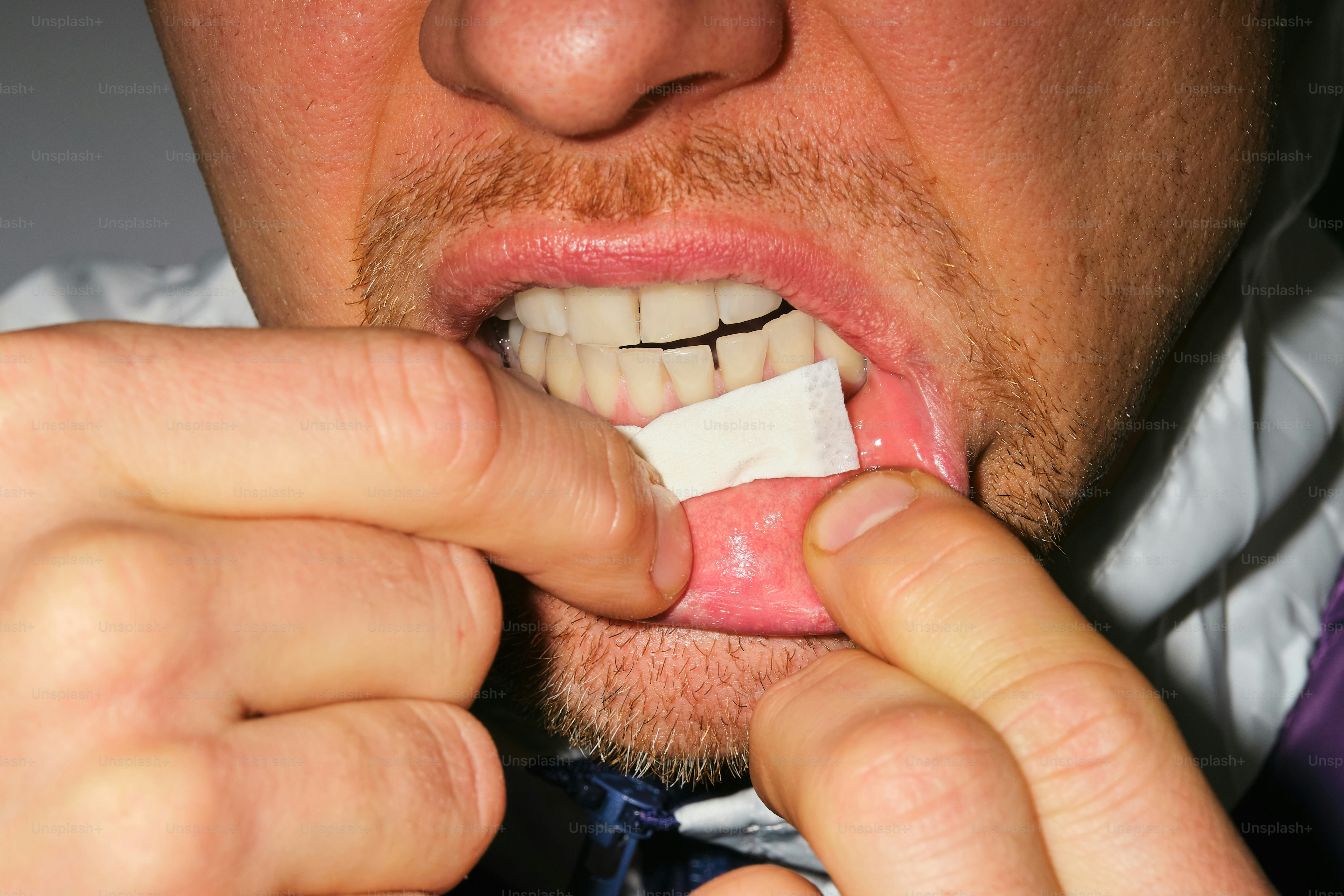 A person is holding a gauze pad in their mouth.
