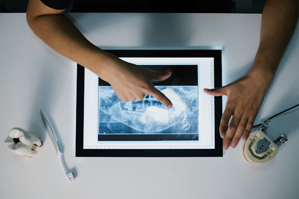 Digital dental technology