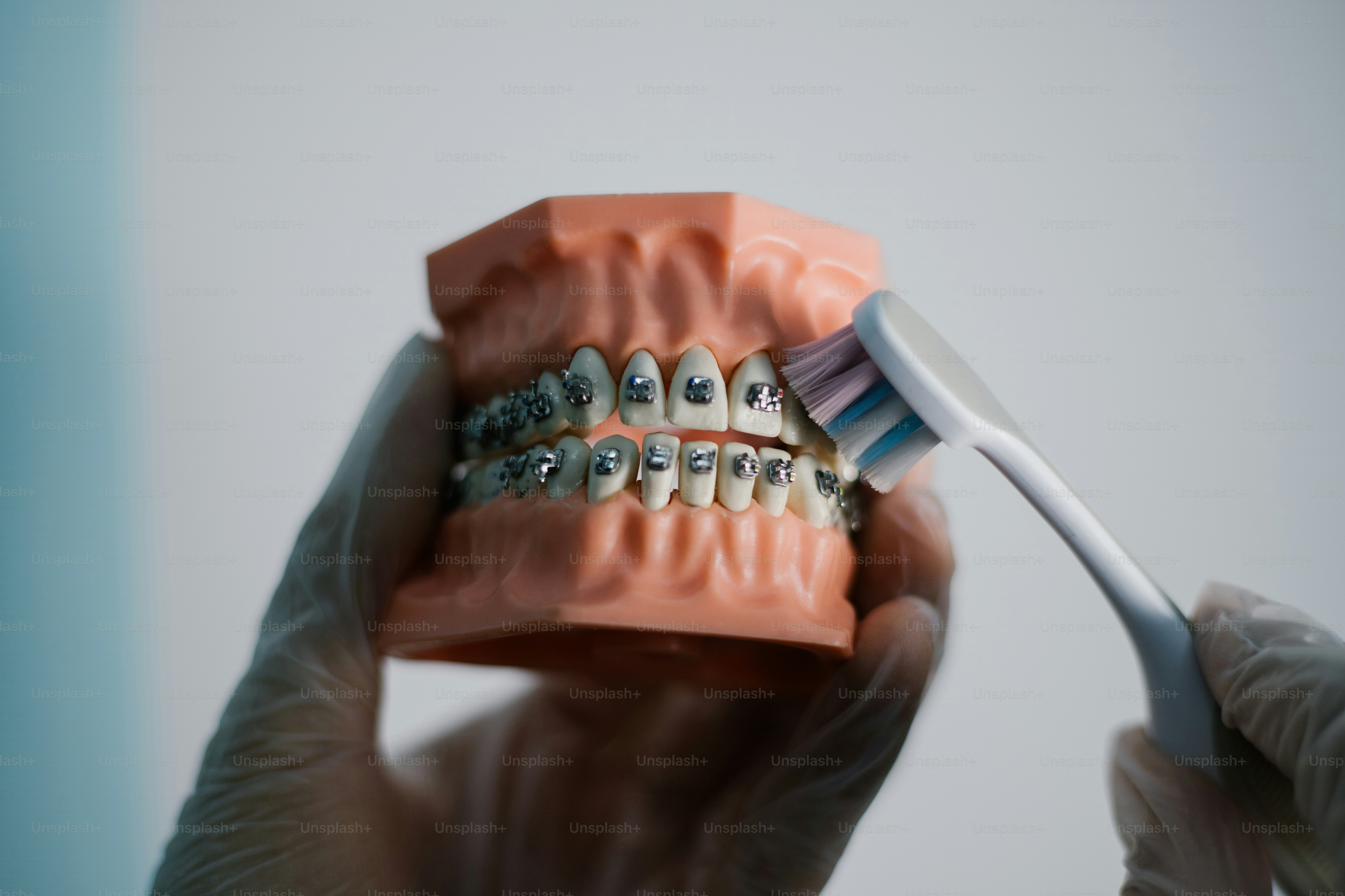 Brushing the teeth with braces on a dental model.