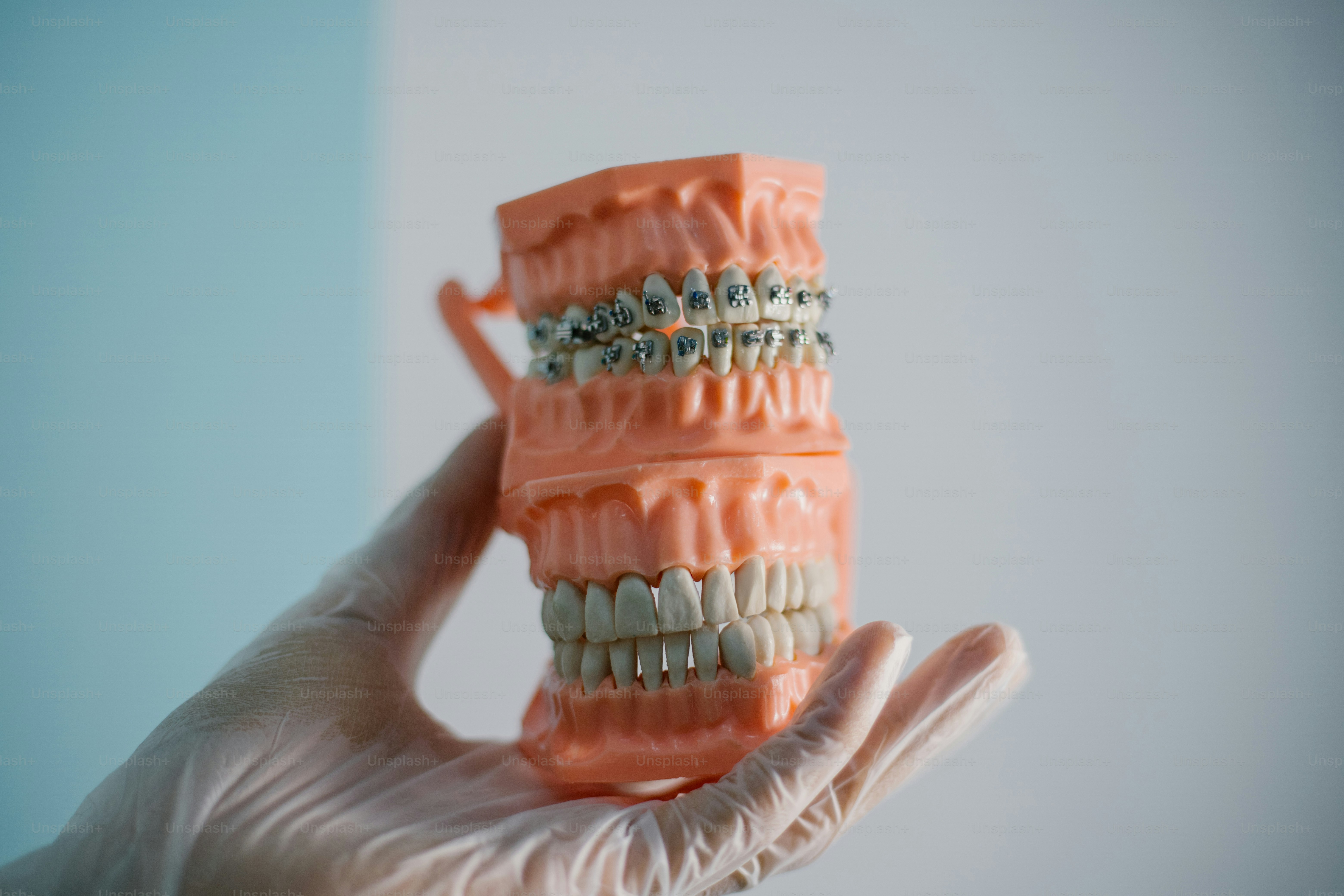 A hand holds a model of teeth with braces.
