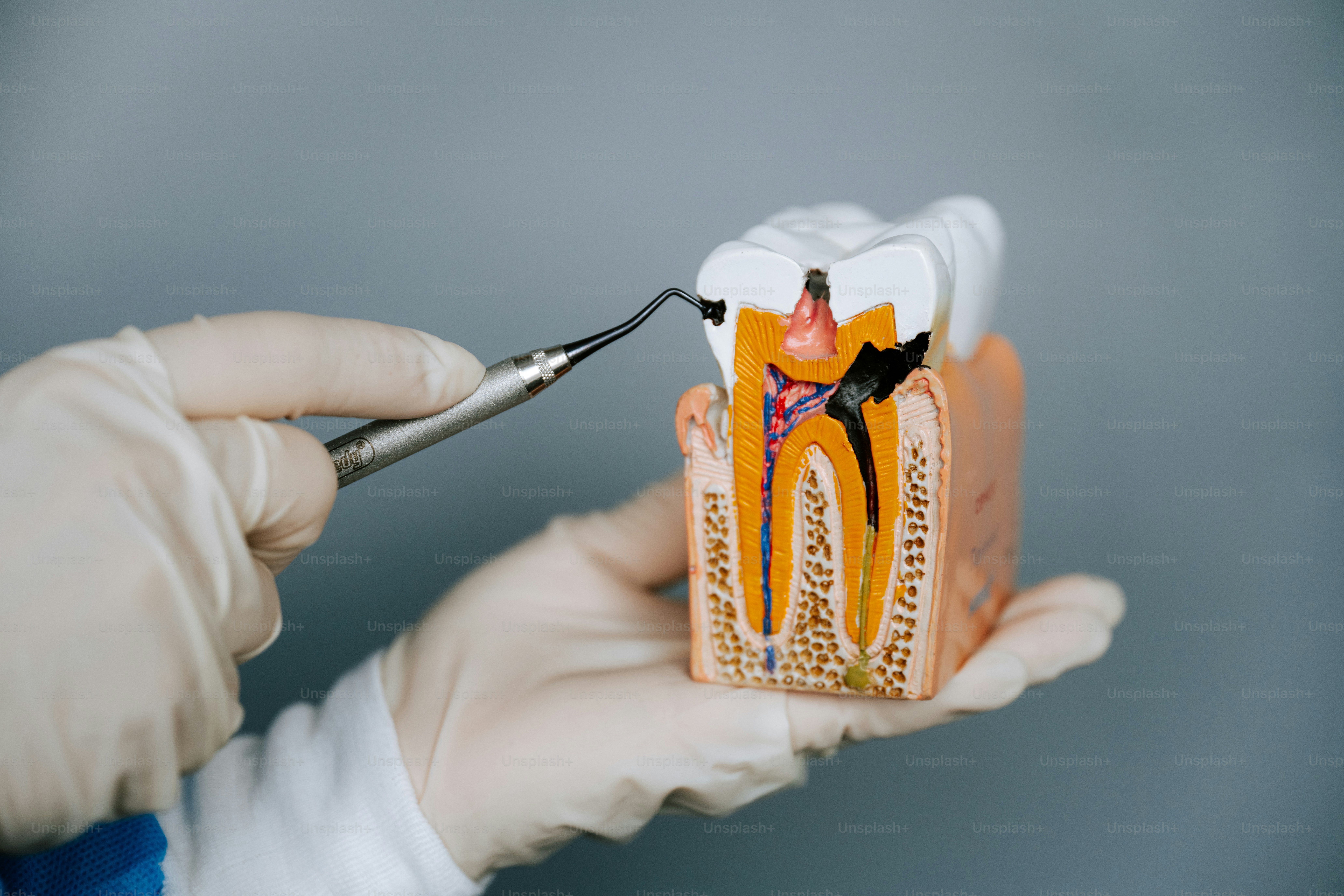 A dentist examines a tooth model.