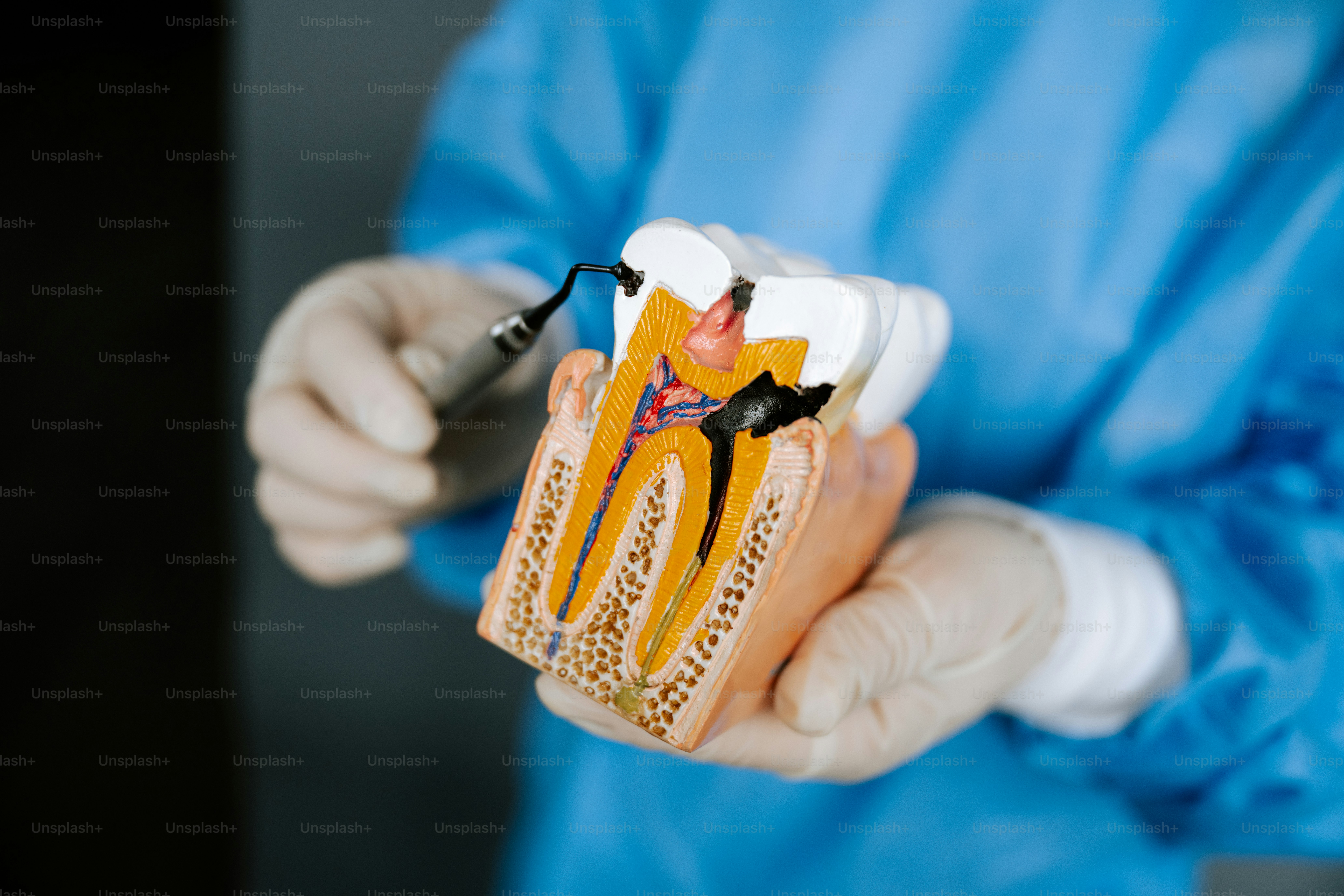 Dentist demonstrates a model of a tooth.