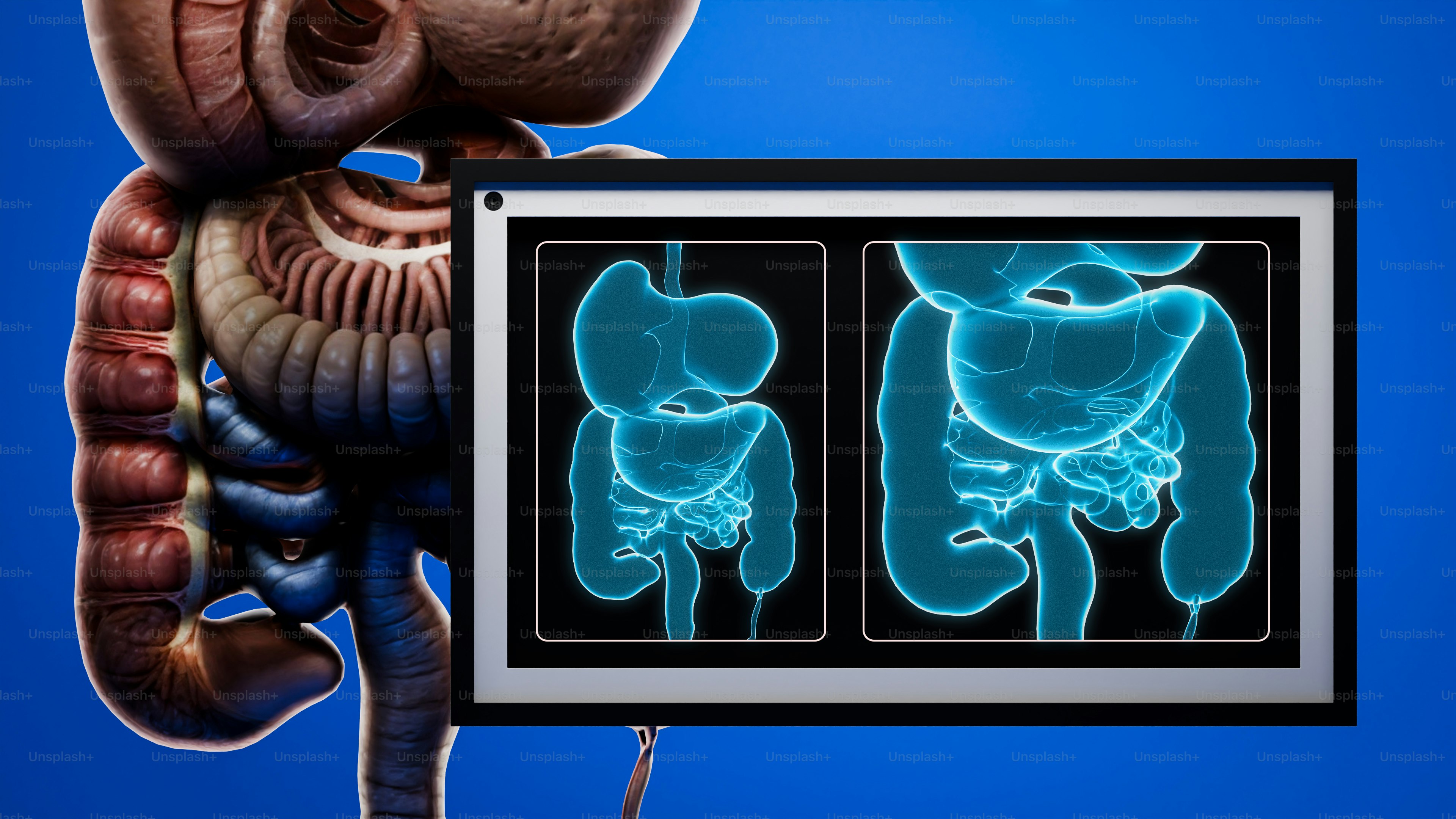 Exames de raios-X do sistema digestivo humano.
