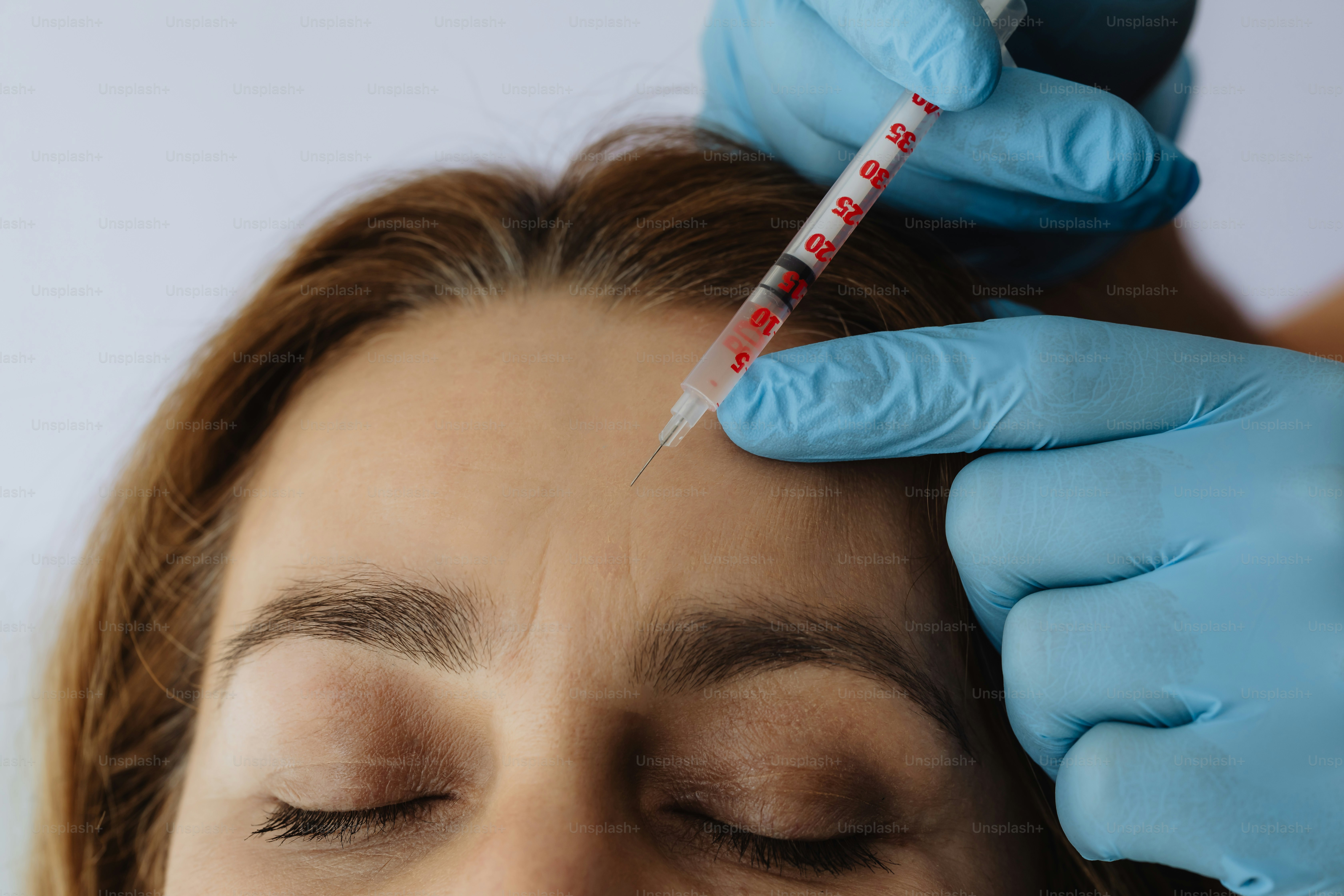 Aesthetic nurse administering anti-wrinkle injections to the forehead
