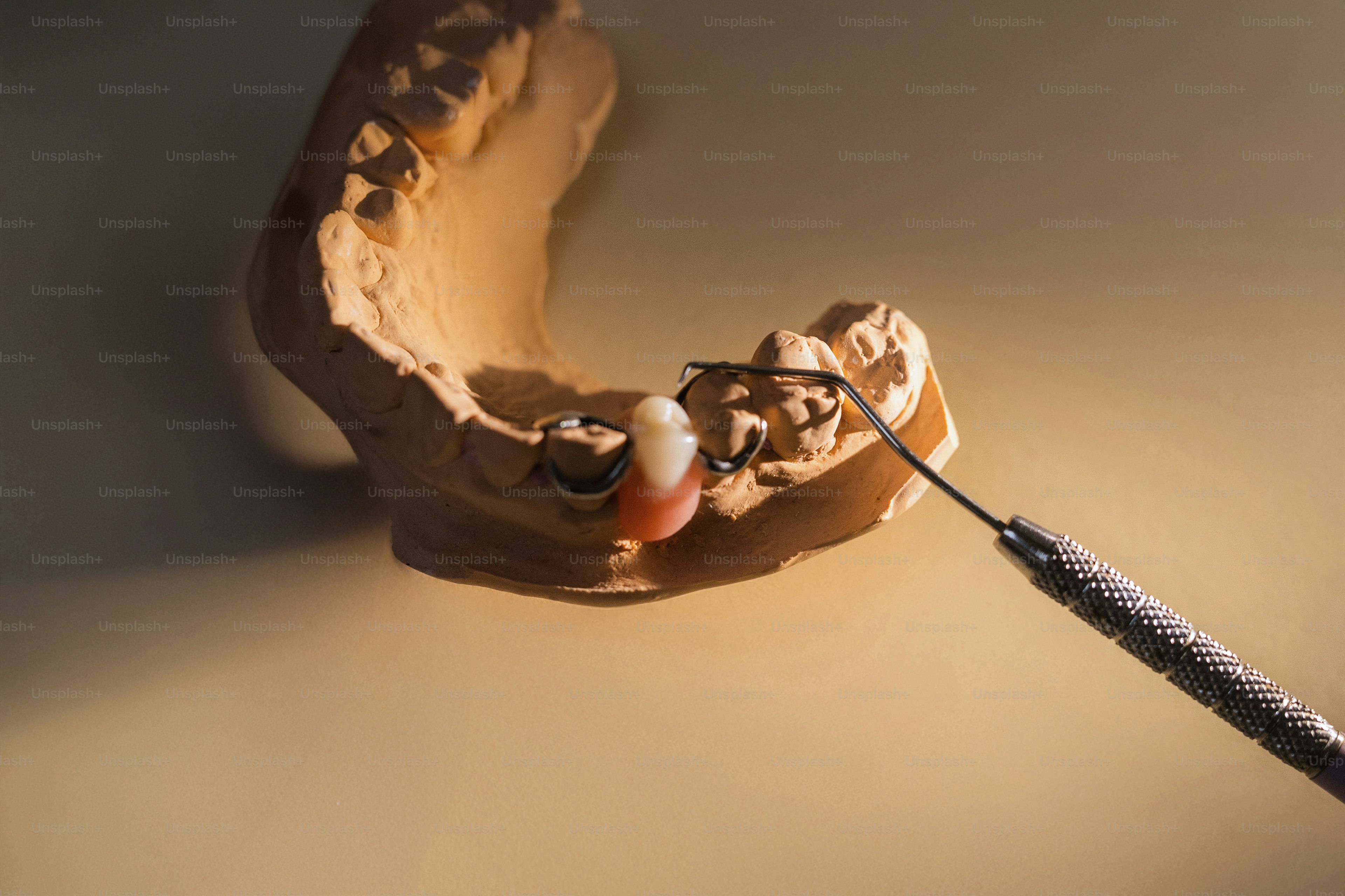 Dentist working on a dental mold.