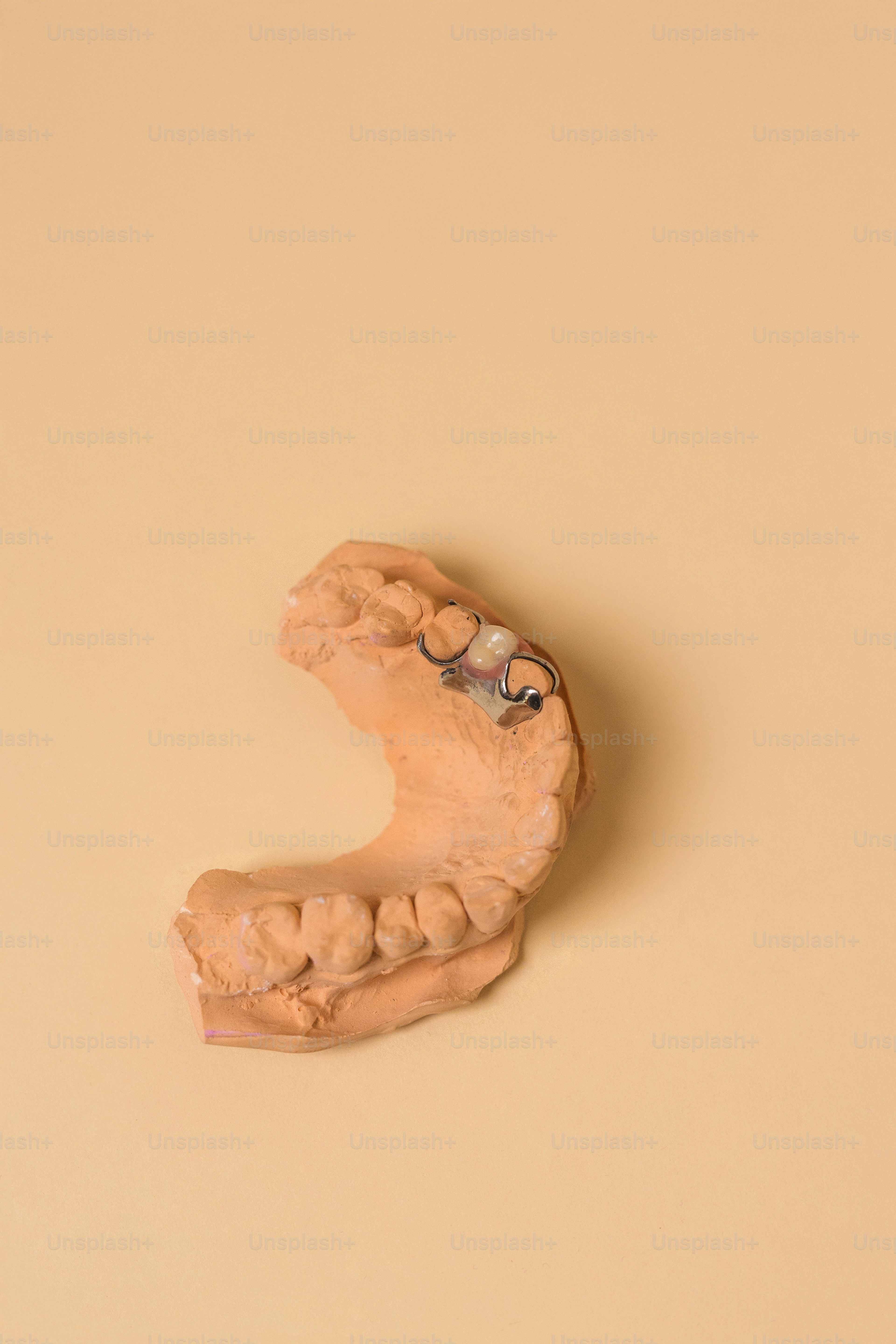 Caso de éxito de Prótesis Flexible