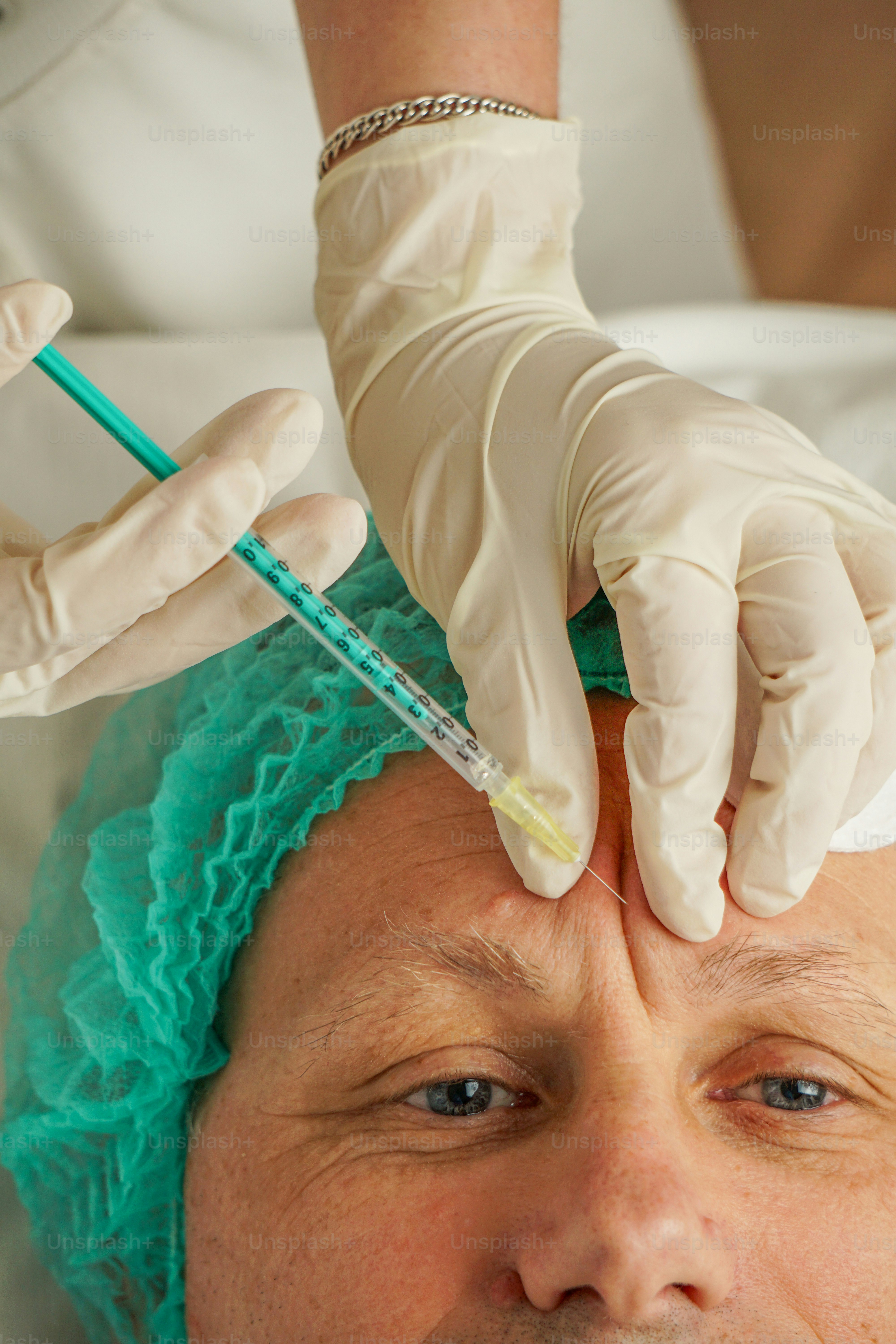 Botox injections being administered to a patient's forehead. photo ...