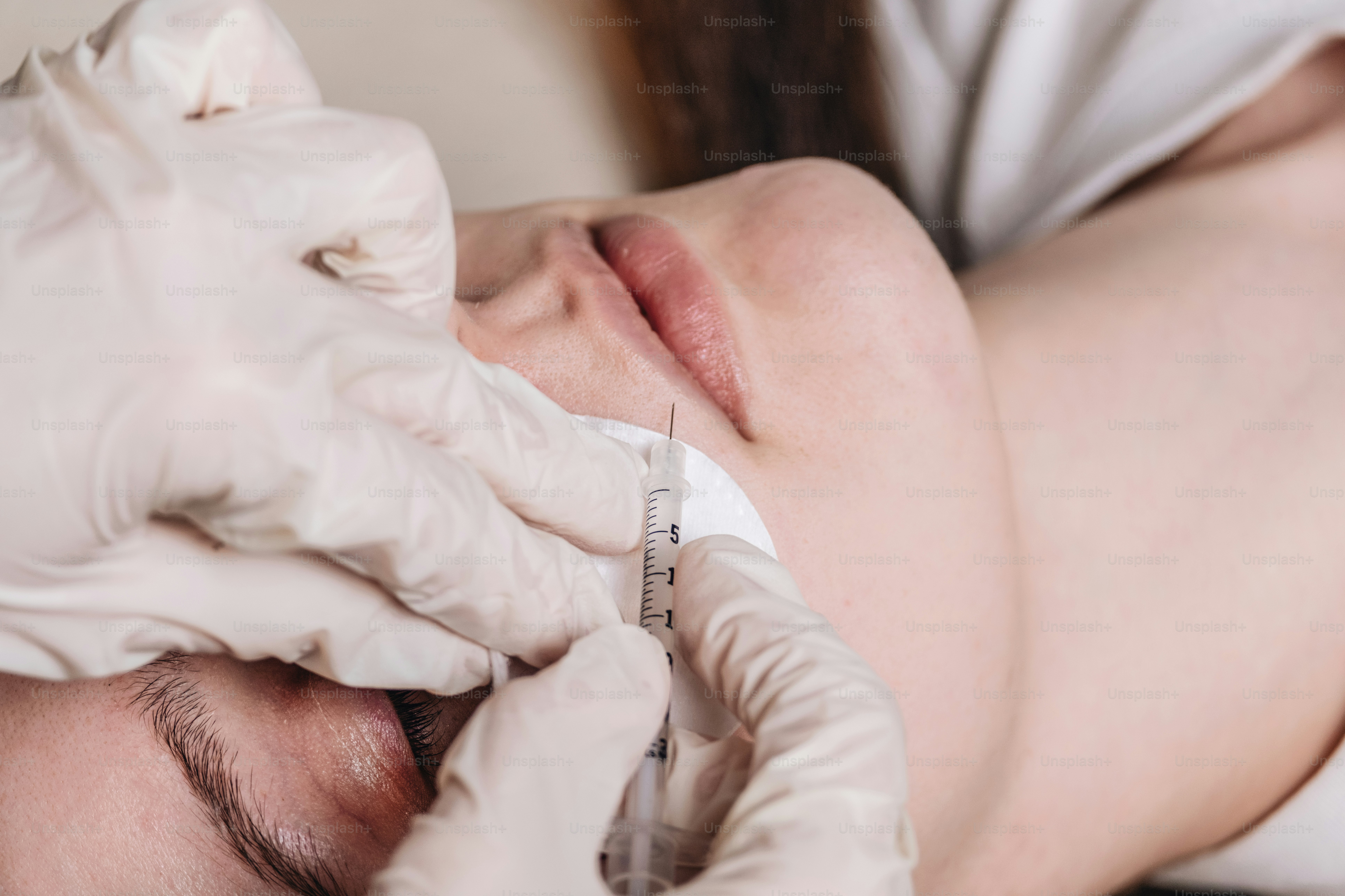 Uma pessoa recebe uma injeção labial.