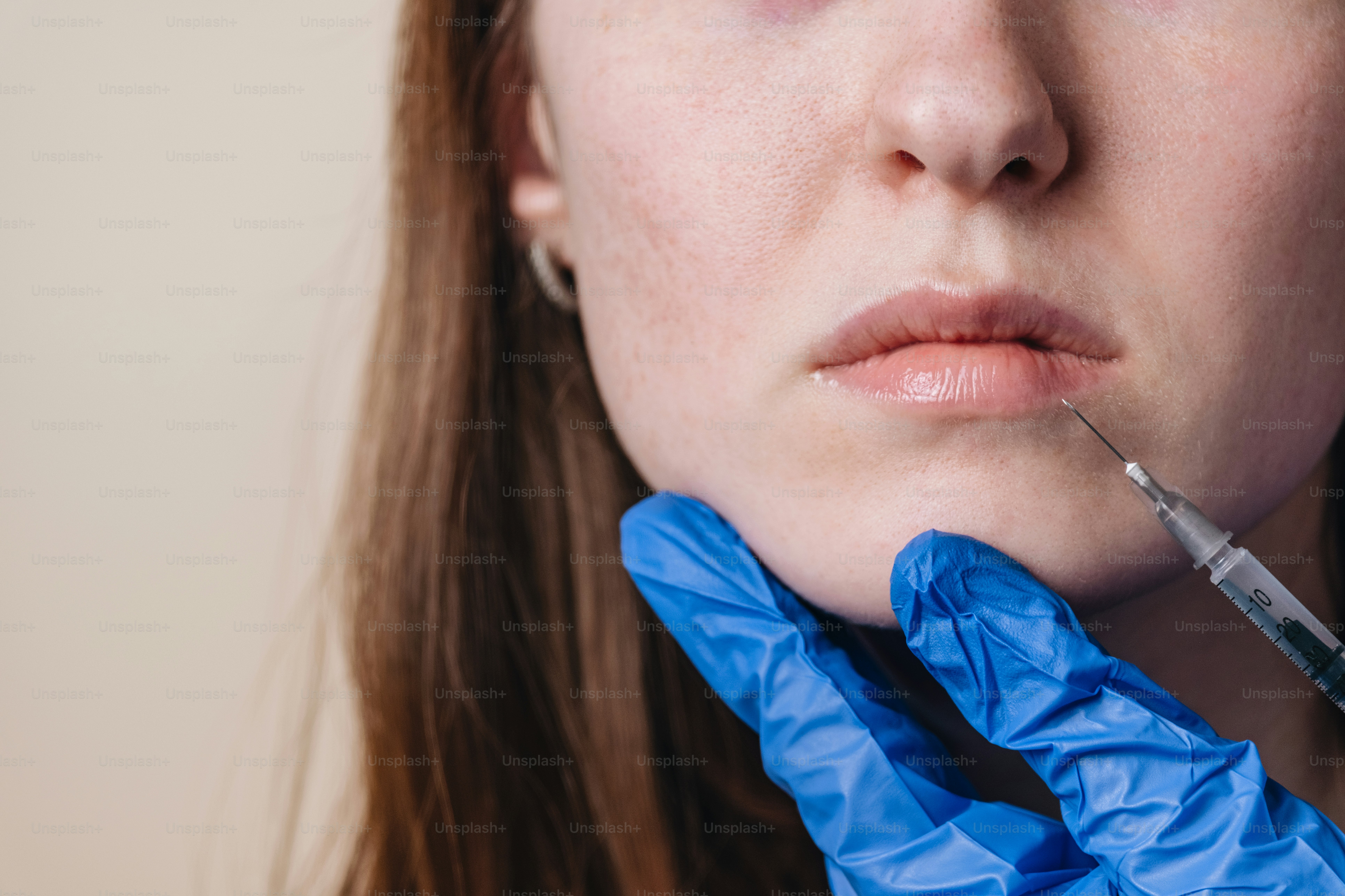 Injeção de preenchimento labial sendo administrada em uma pessoa.