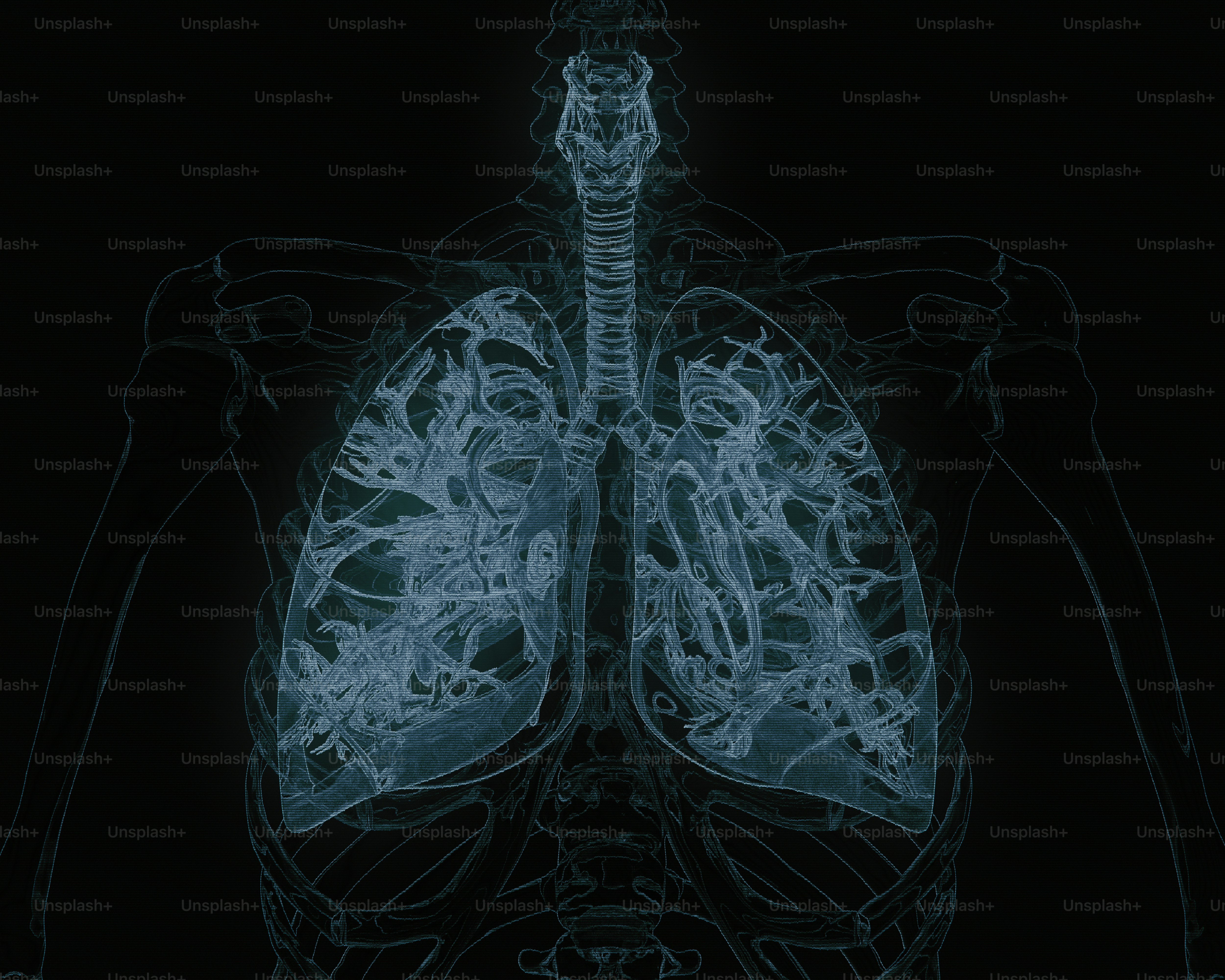 X-ray shows a detailed view of human lungs.