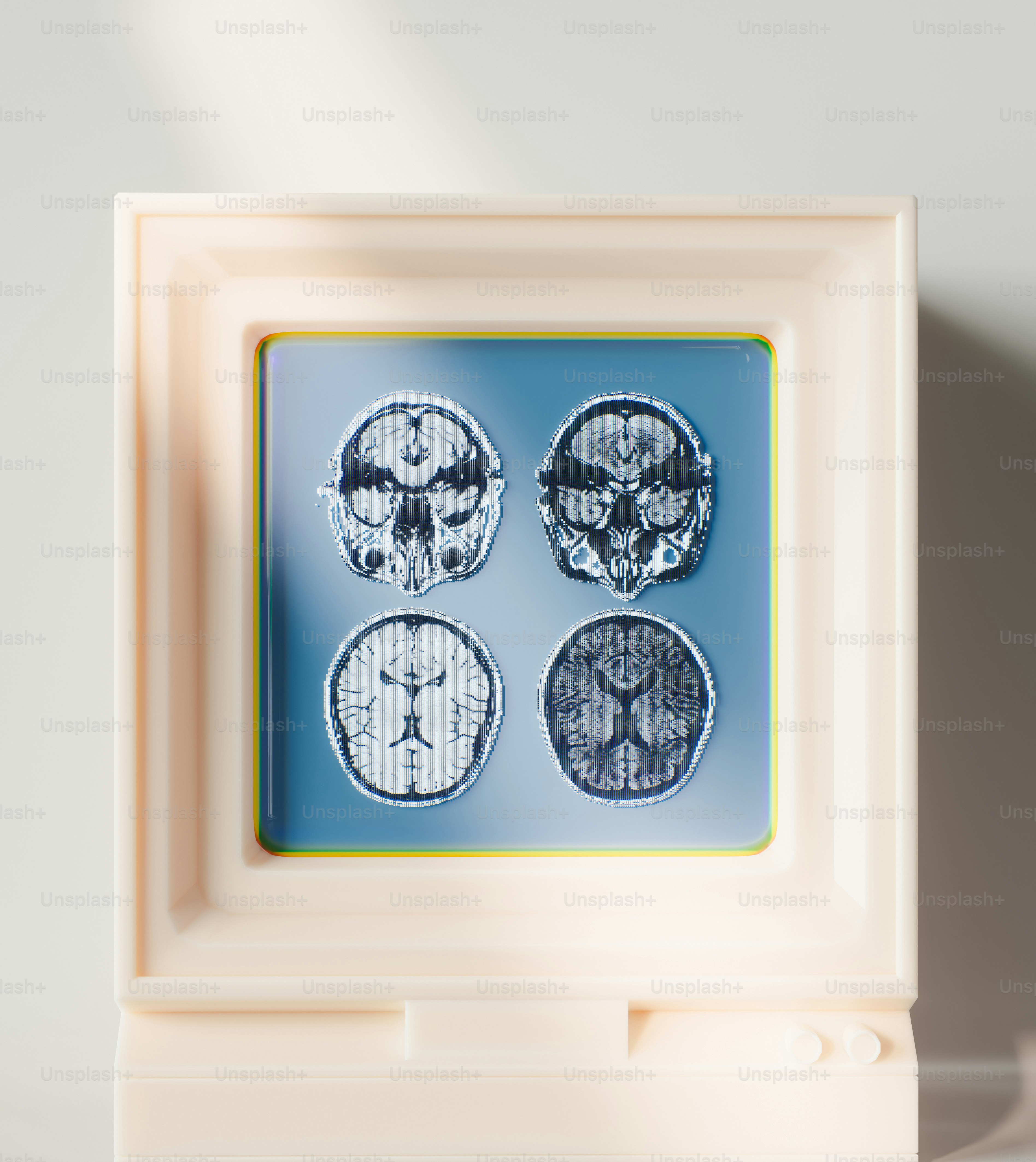 Brain scans are displayed in a square wooden frame. photo – Health ...