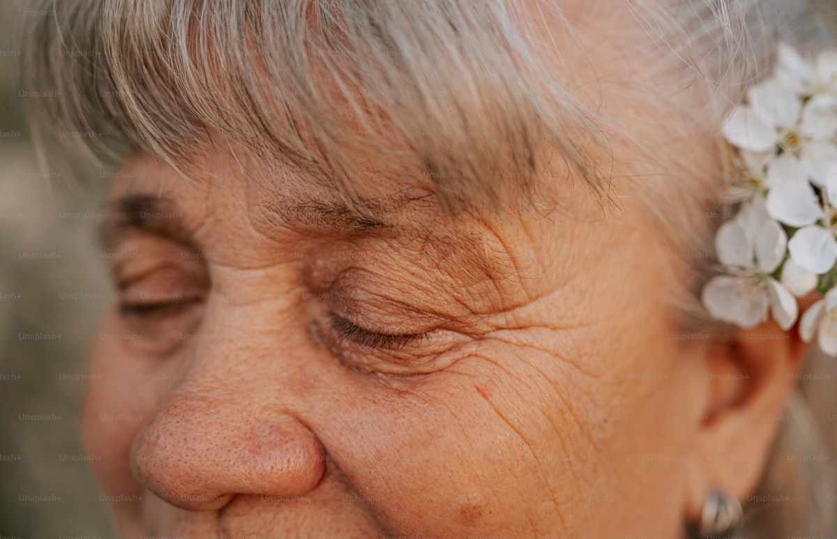 After - Revitalized Skin