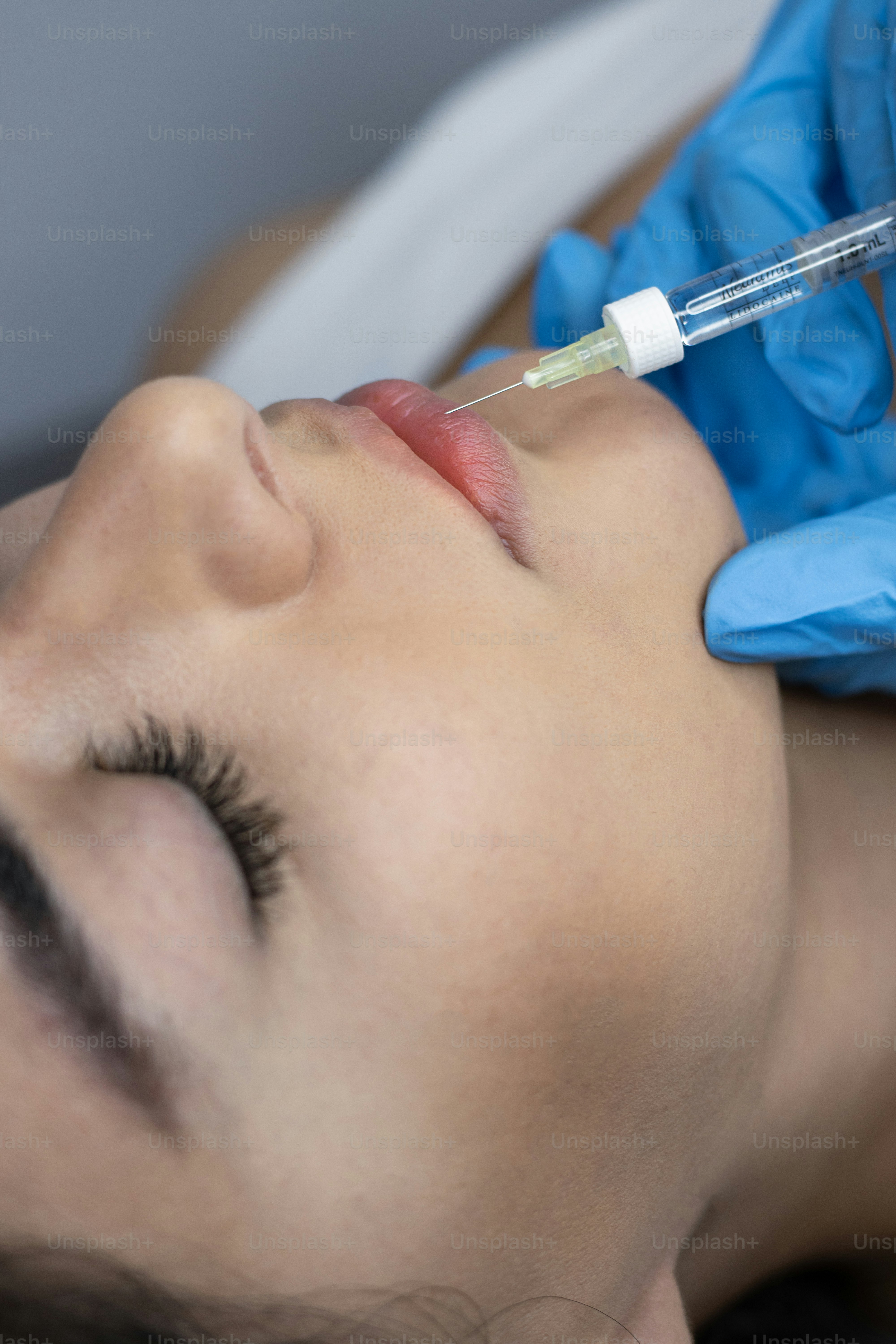 Lip injections are being administered to a patient. photo – Health ...