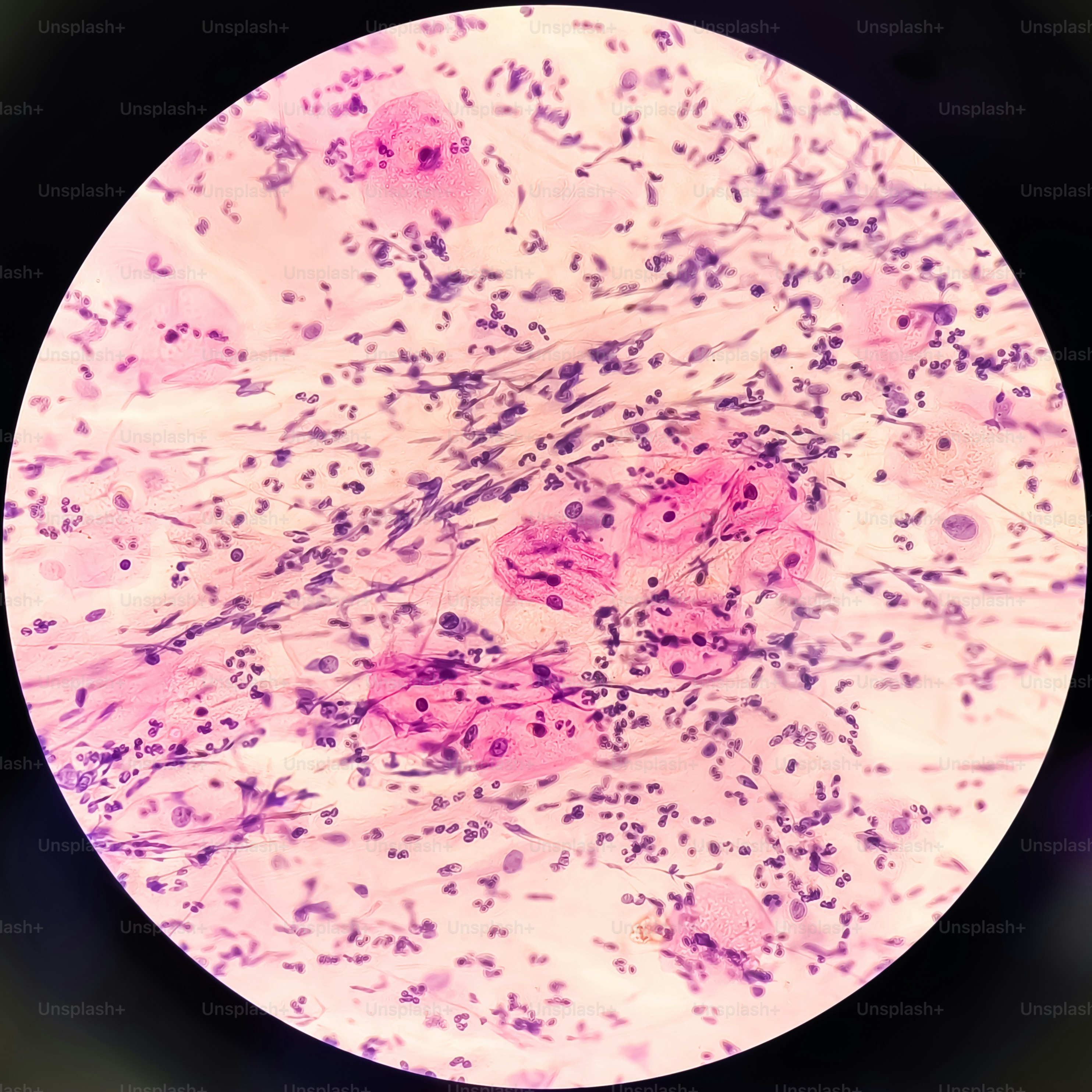 premium_photo-1754337720095-51118ab20e48?ixid=M3wxMjA3fDB8MXxzZWFyY2h8MTd8fCVEMCU5RCVEMCVCMCVEMCVCOS0lRDAlQjQlRDAlQkUlRDAlQjElRDElODAlRDAlQjglRDElODIlRDAlQjUlMjB0dWJlciUyMG1lbGFub3Nwb3J1bXxlbnwwfHx8fDE3NjUxMDE4Njd8MA\u0026ixlib=rb-4.1.0