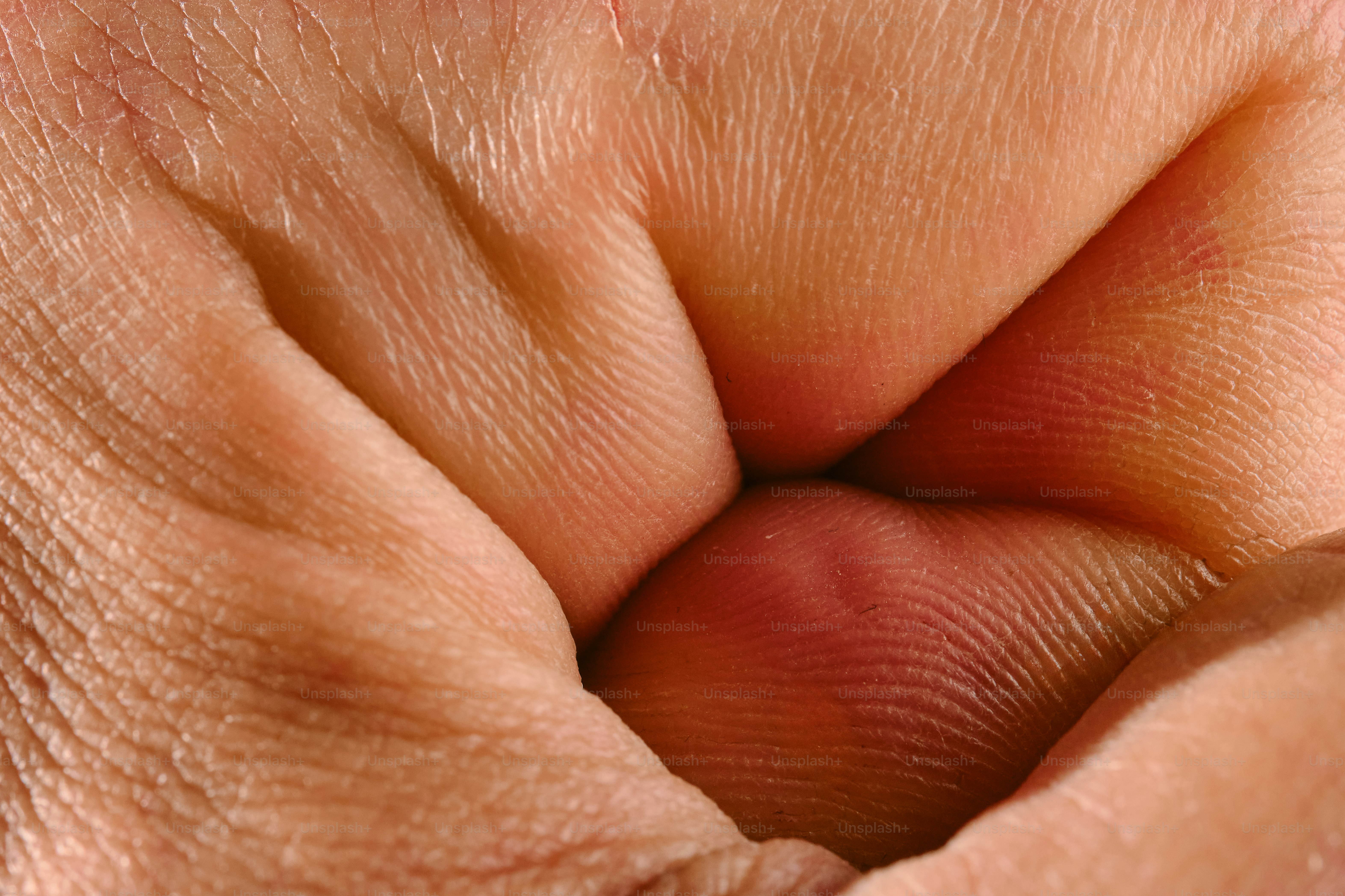 Close-up of a clenched fist with a small bump.