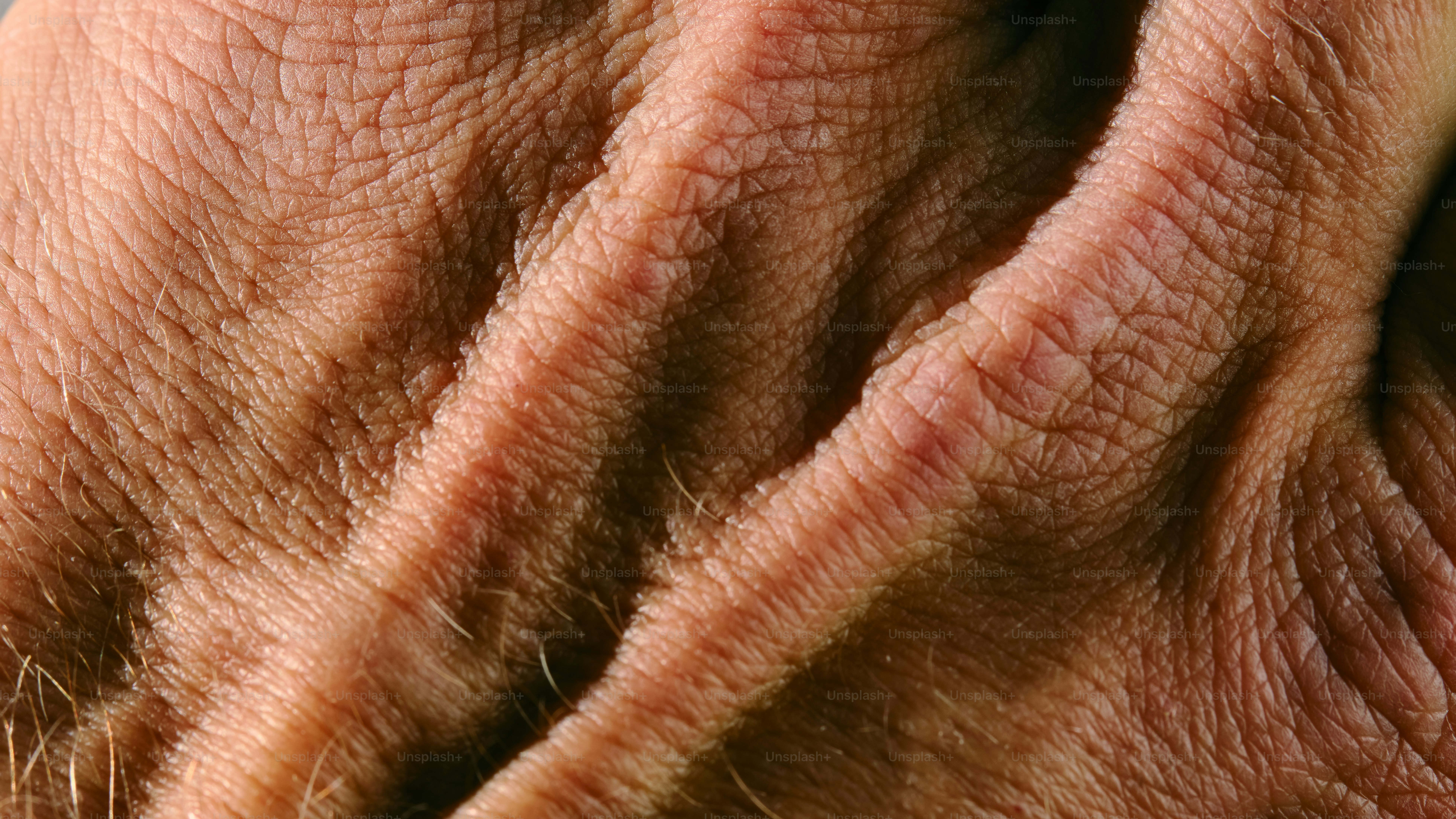 Close-up of wrinkled skin on a hand.