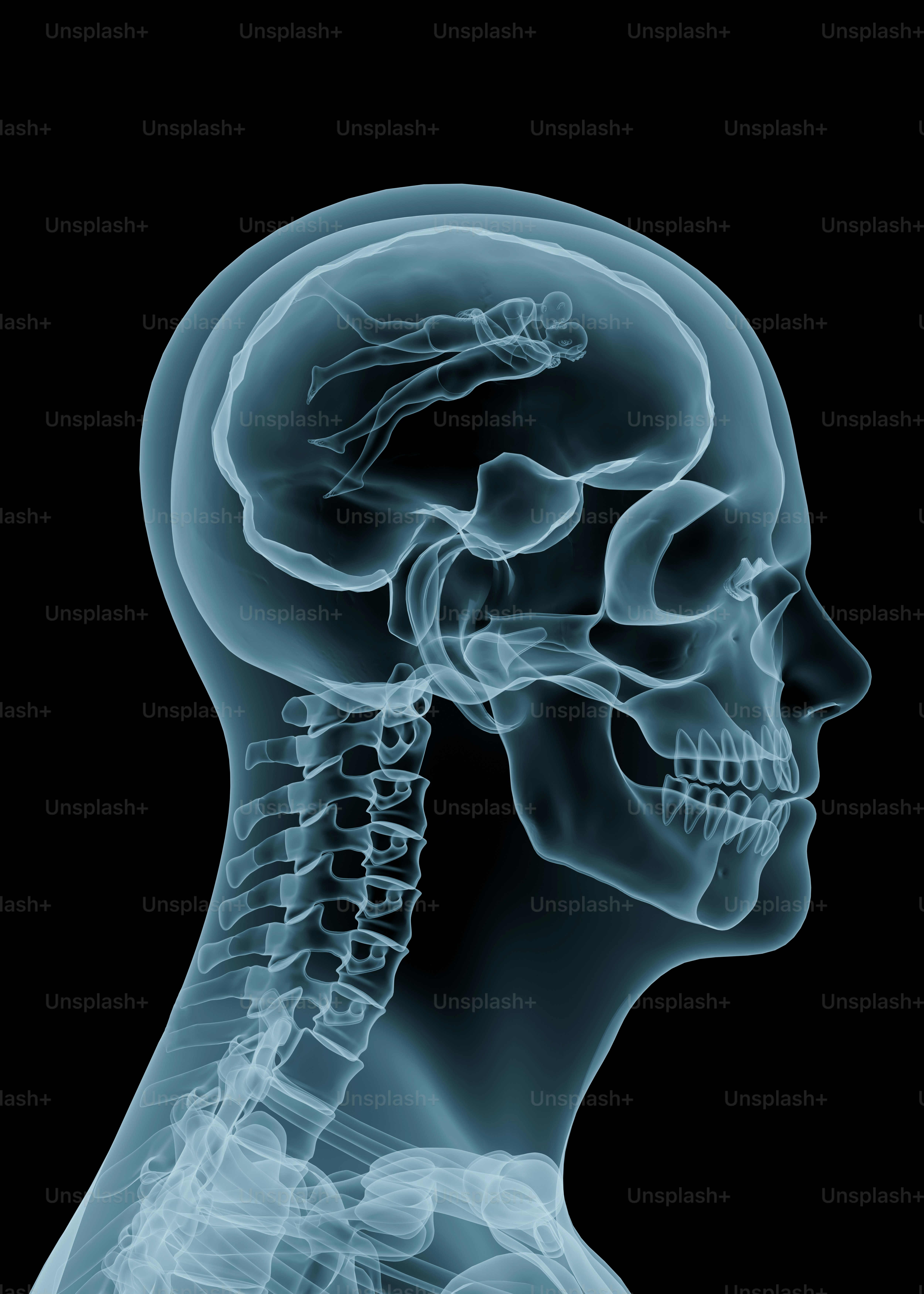 X-ray of a human head and brain