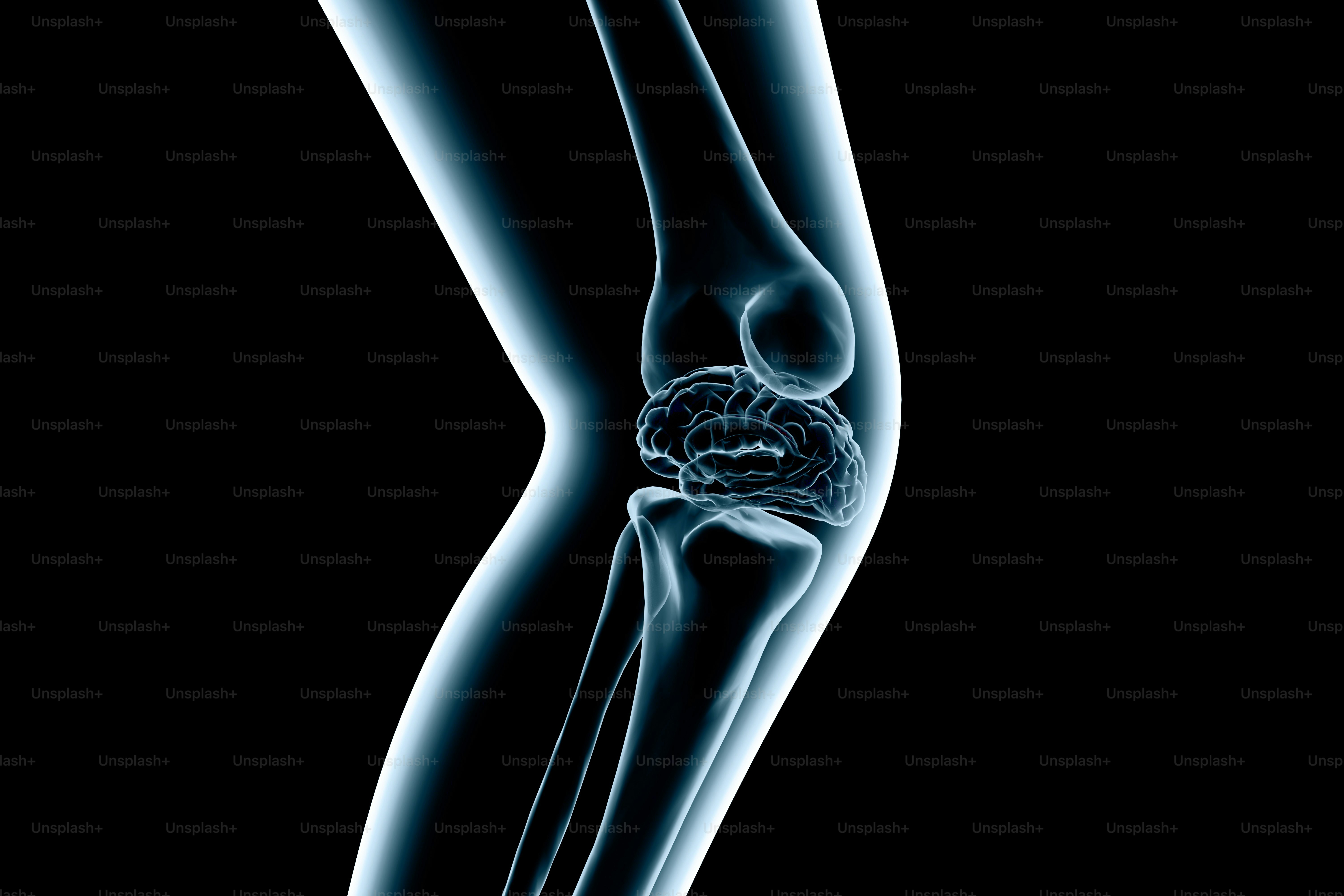 Radiographie d’une articulation du genou humain sur fond noir