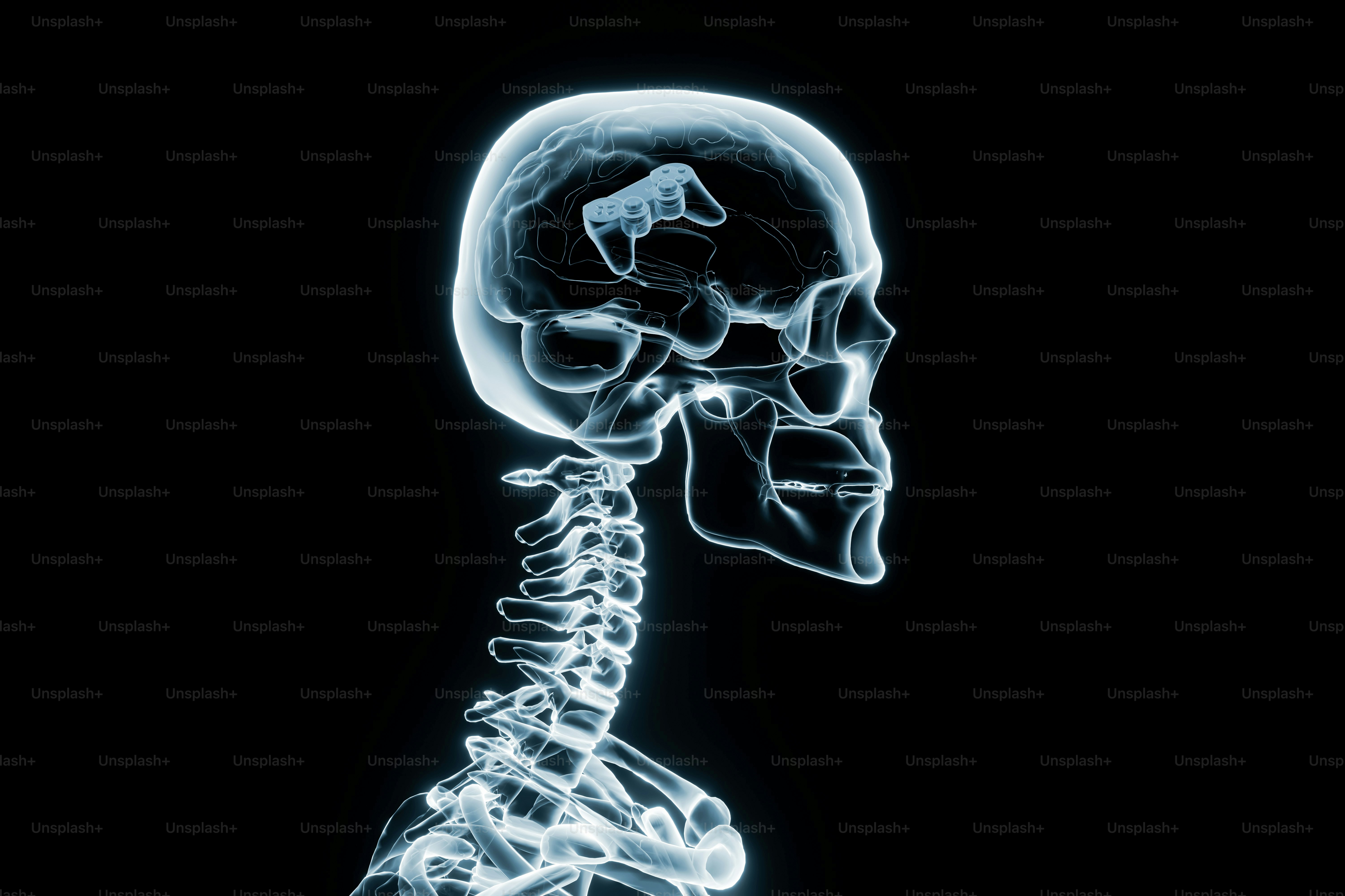 X-ray of a human skull and spine