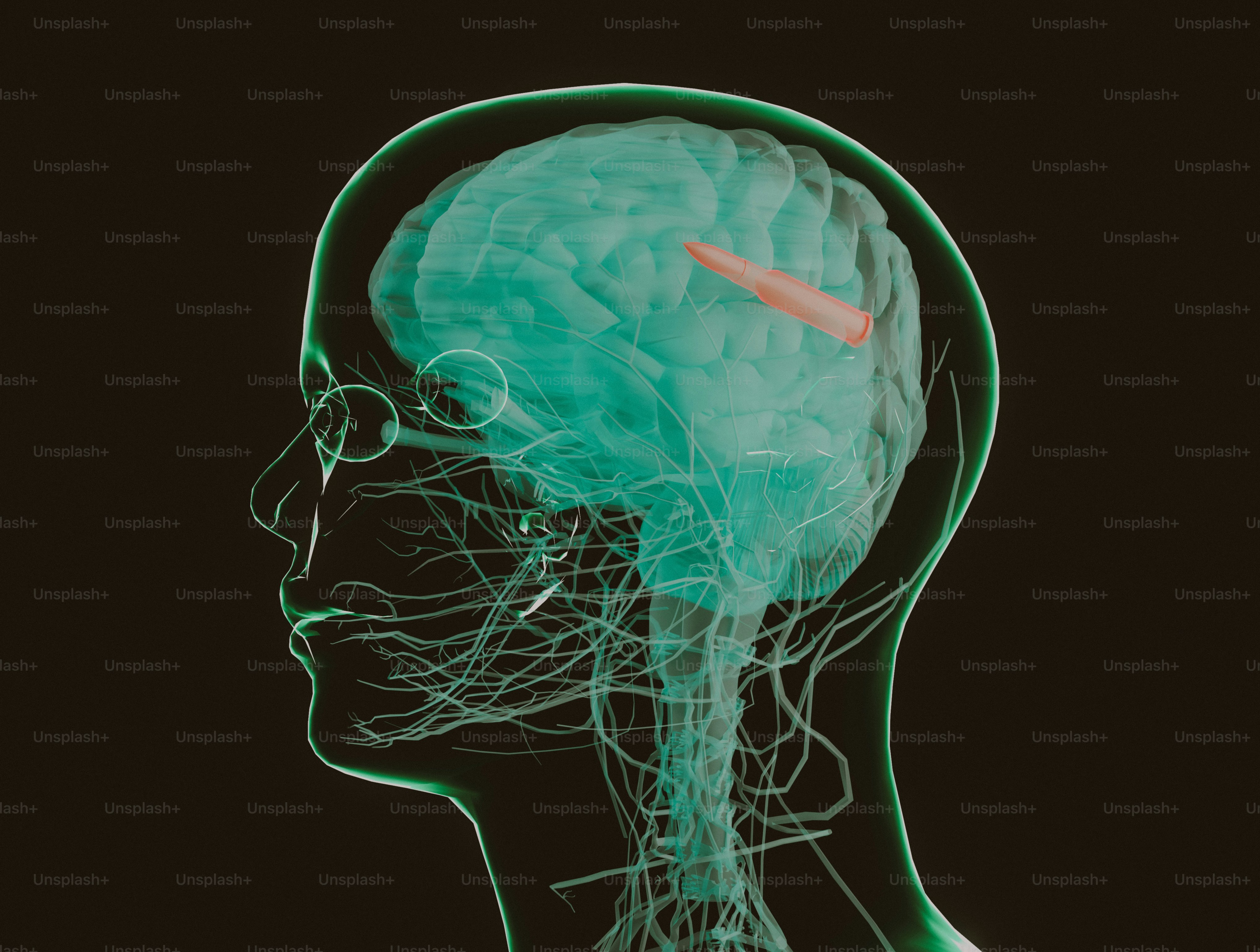 Rendering 3D di un cervello umano con una sonda.