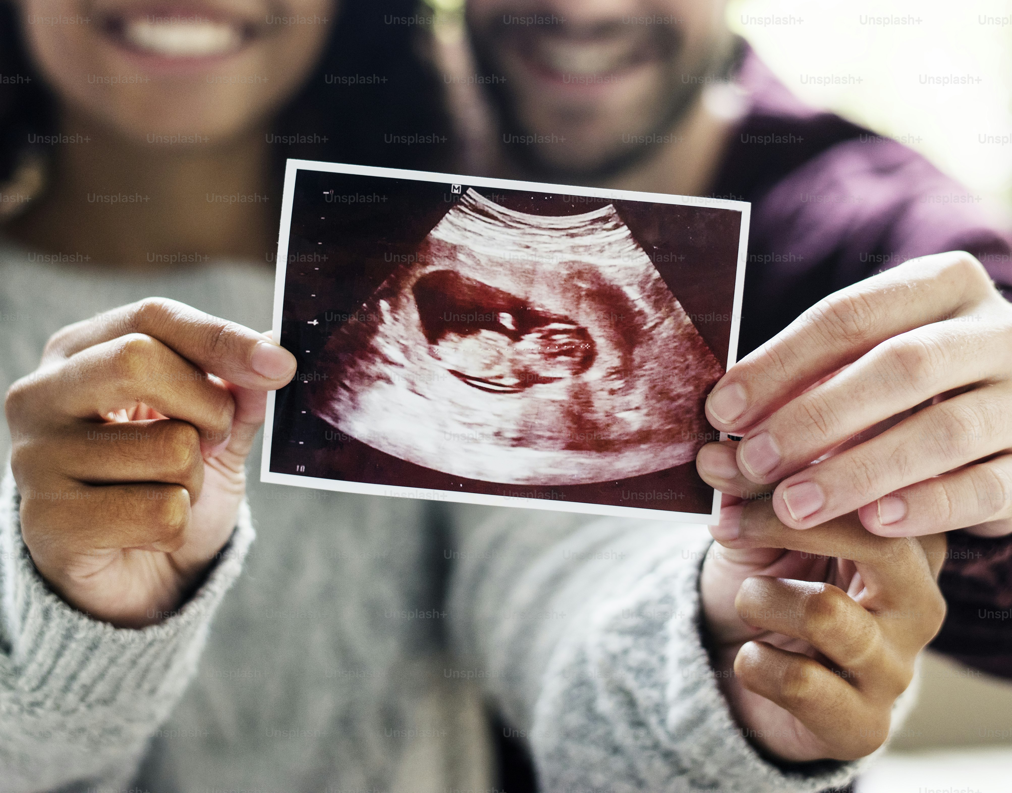 4D ultrasound imaging