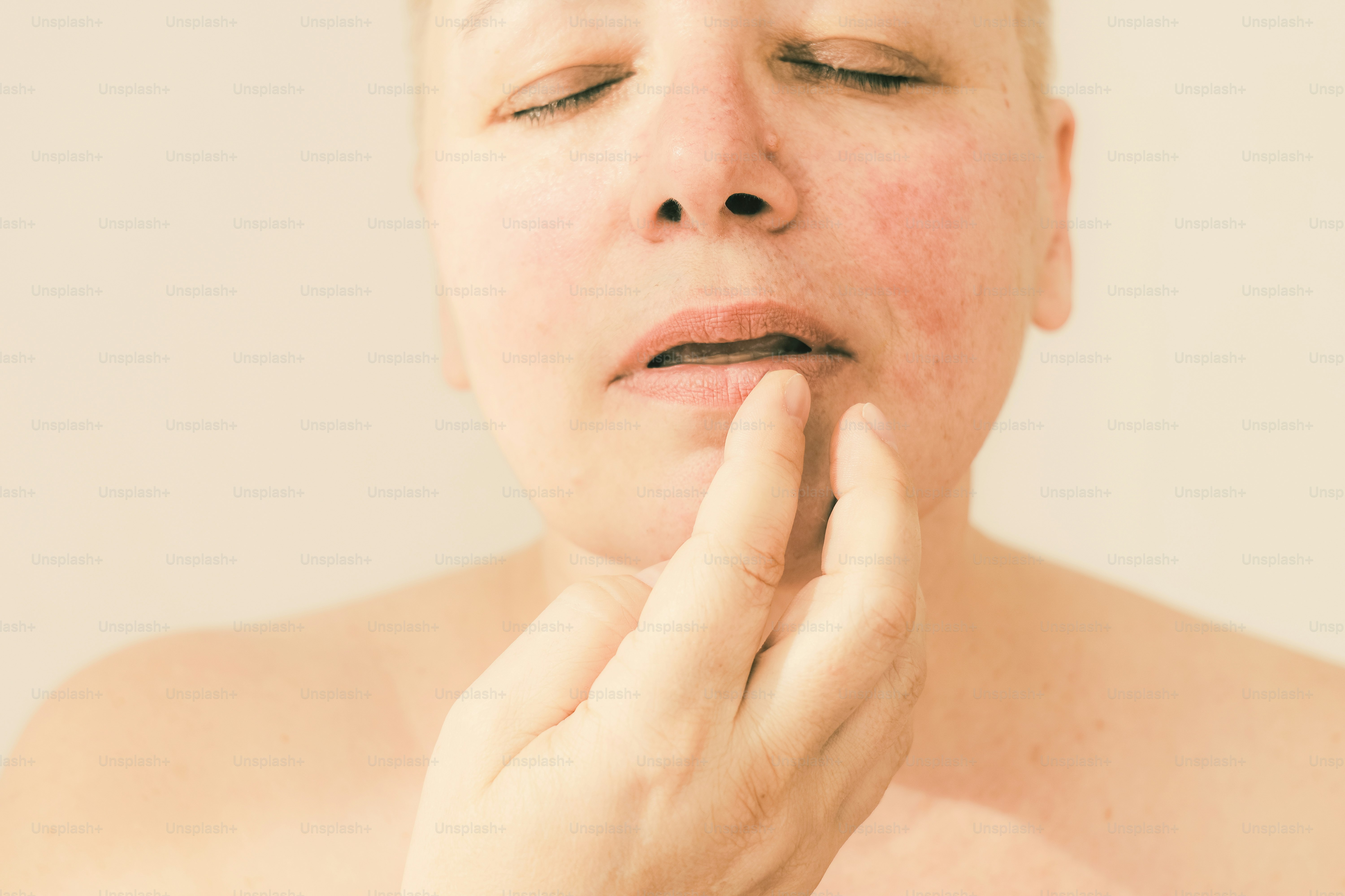Close-up of a person with redness on their face.