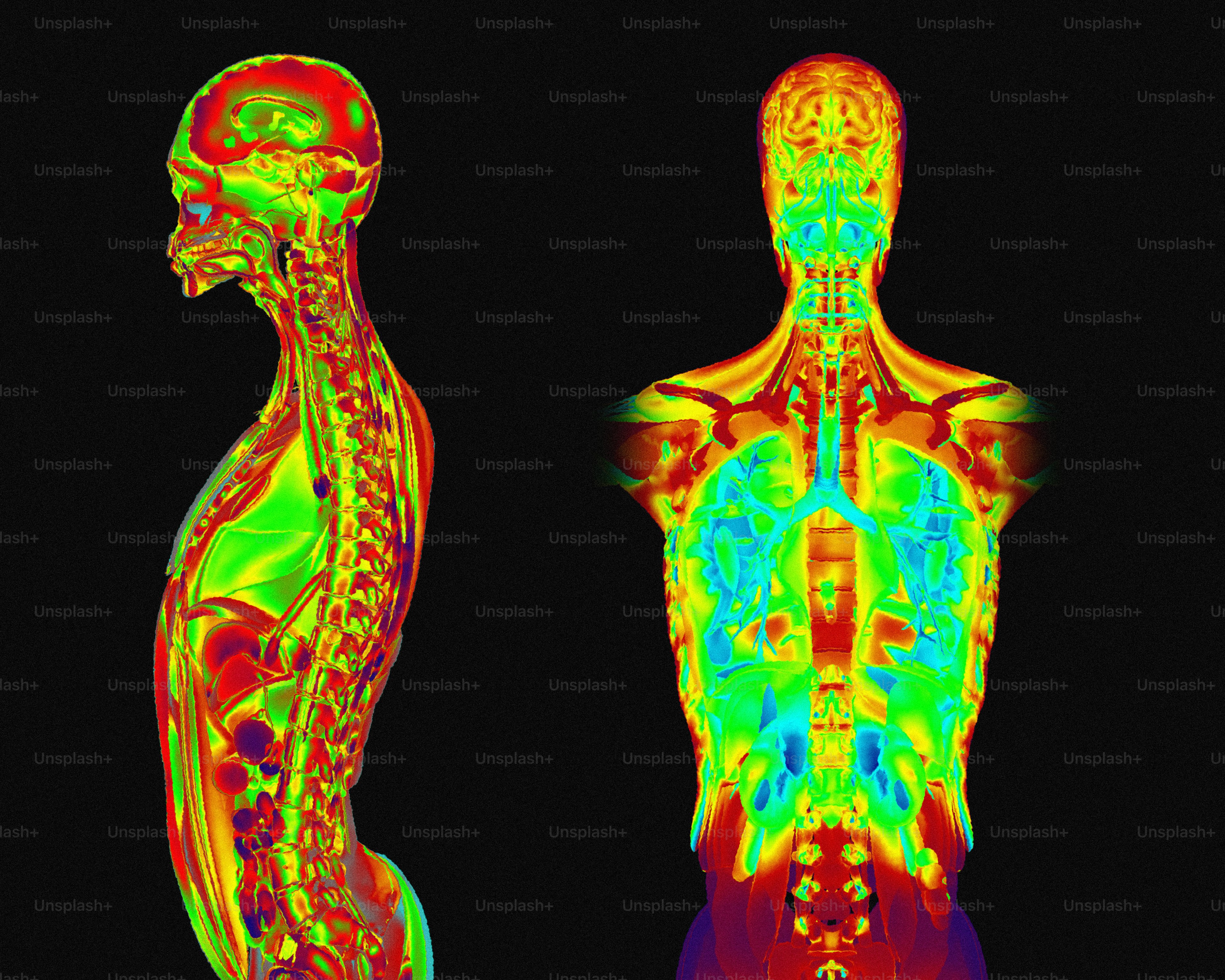 Escaneamentos médicos coloridos do corpo humano mostrando órgãos internos.