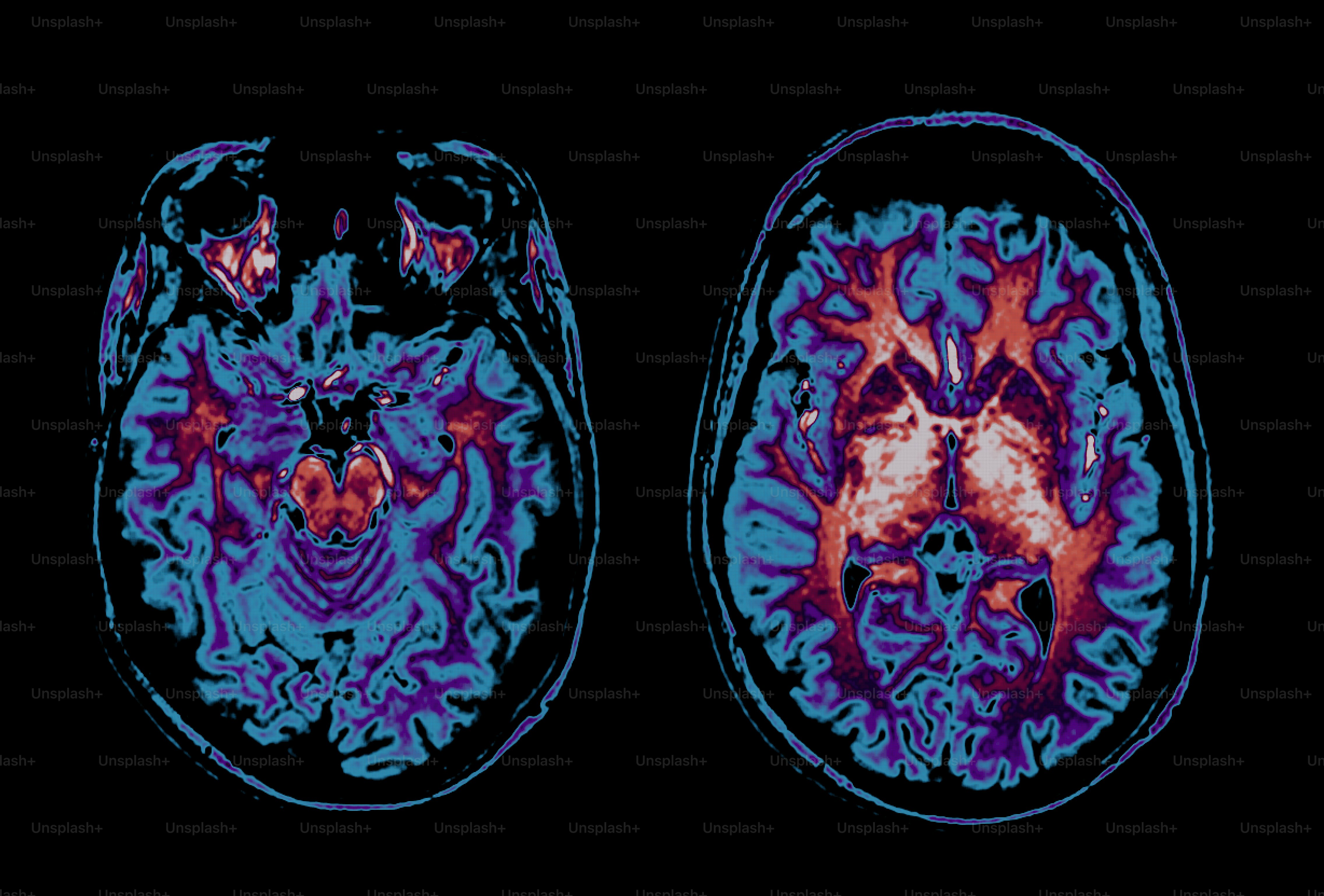 Colorful mri scan of a human brain with eyes. photo – Healthcare Image ...