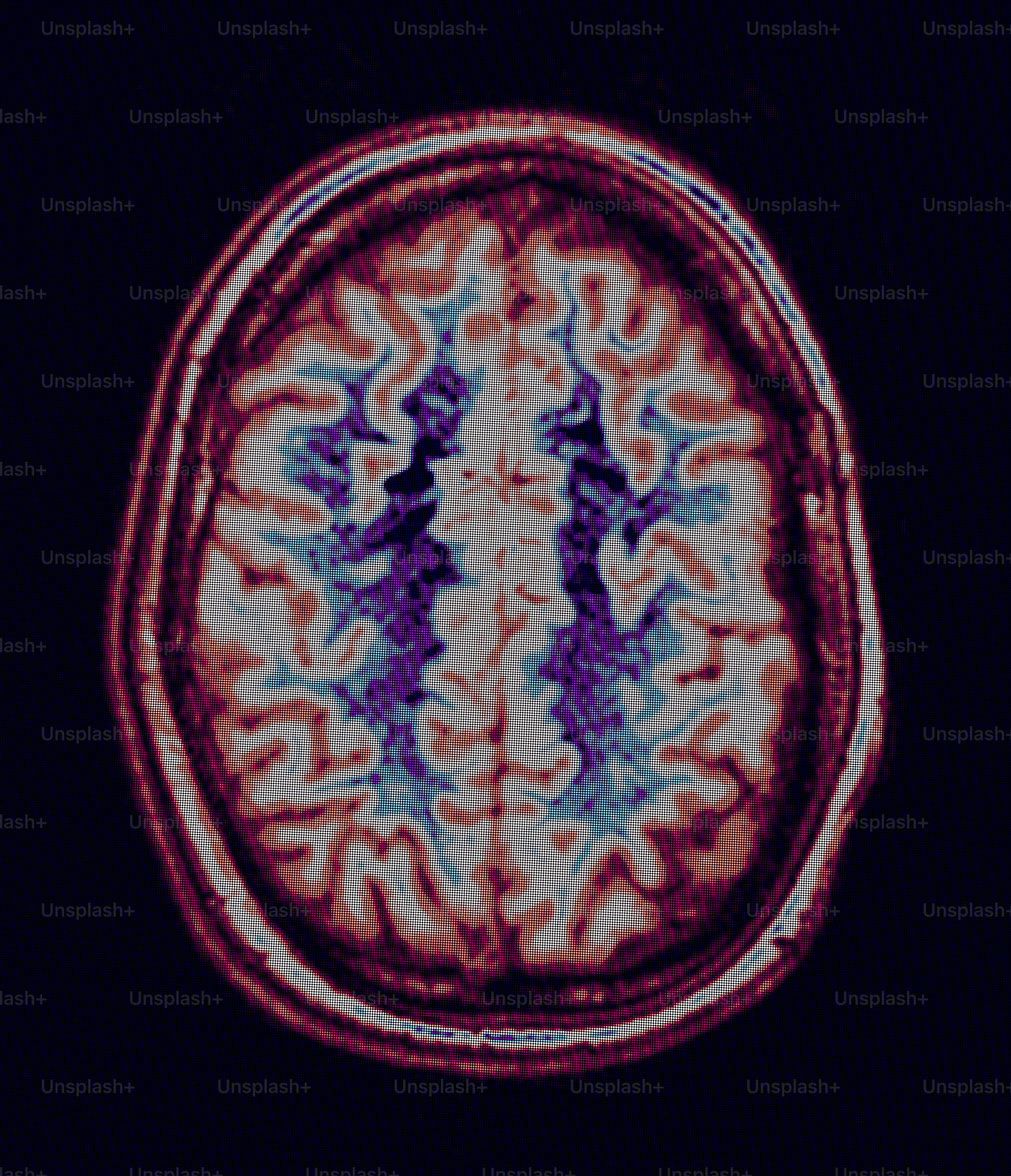 Colorful mri scan of a human brain with eyes. photo – Healthcare Image ...
