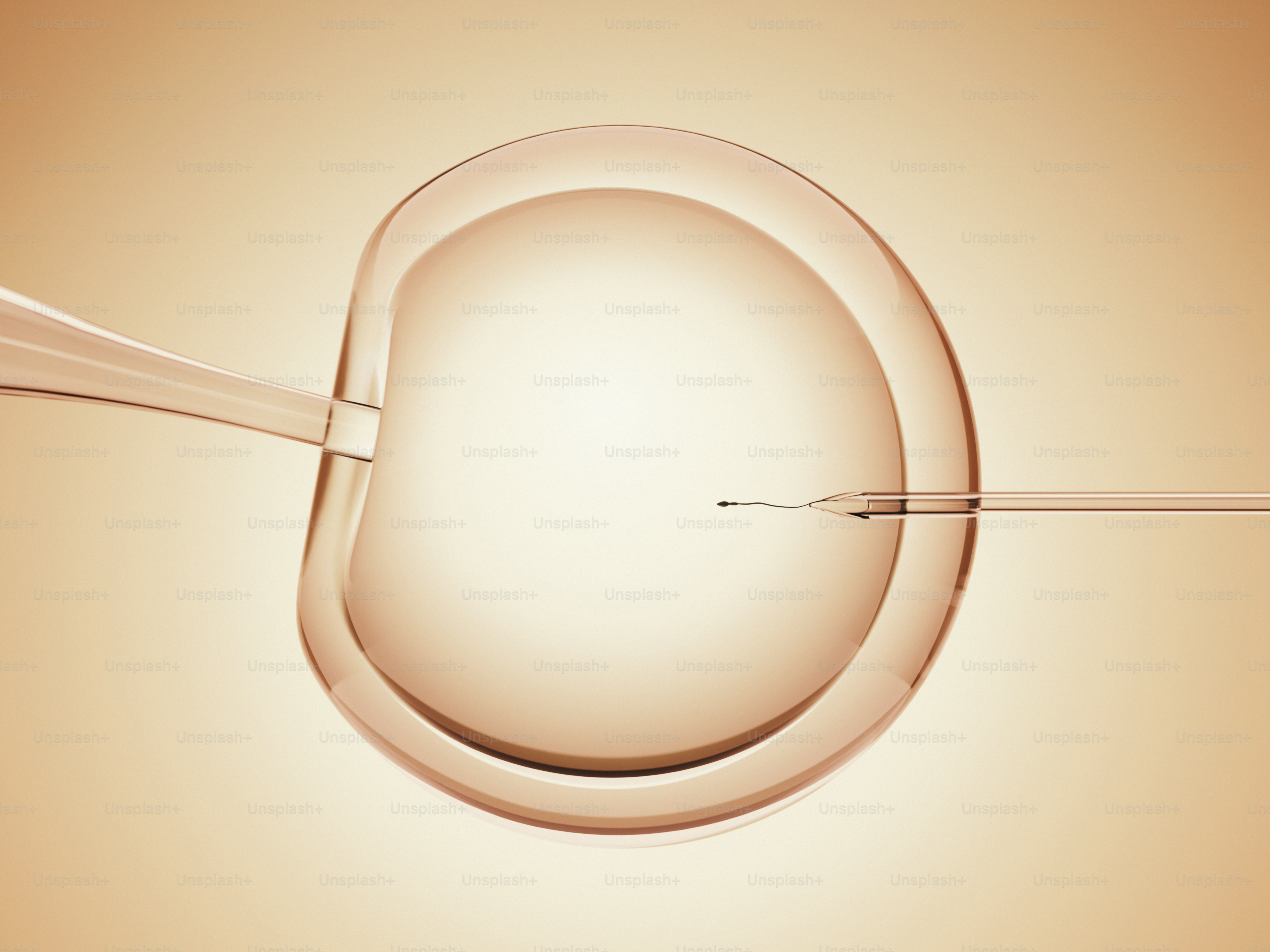 A needle performing microinjection on a cell. photo – Healthcare Image ...