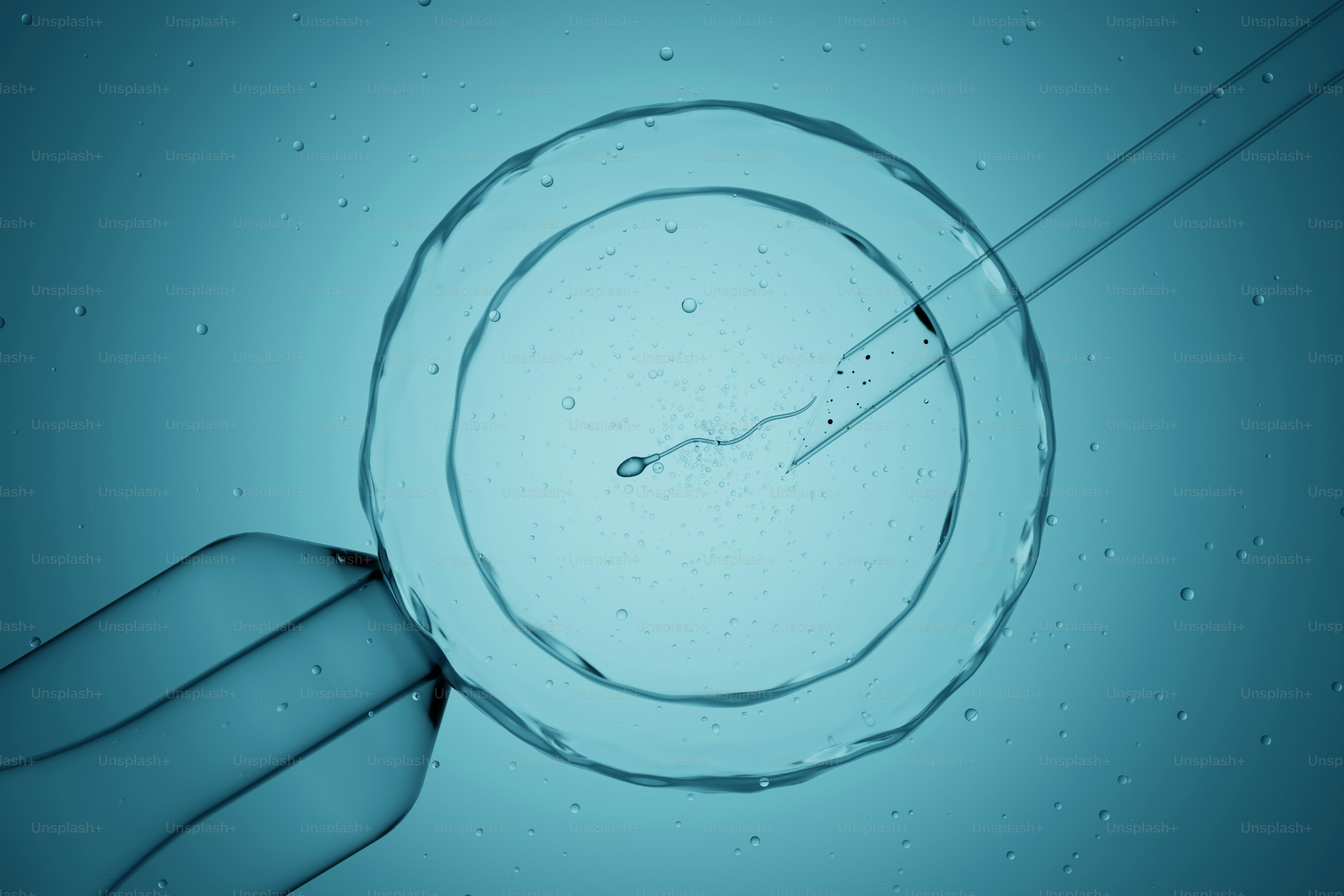 Tampilan mikroskopis sperma yang menyuntikkan sel telur selama ivf.