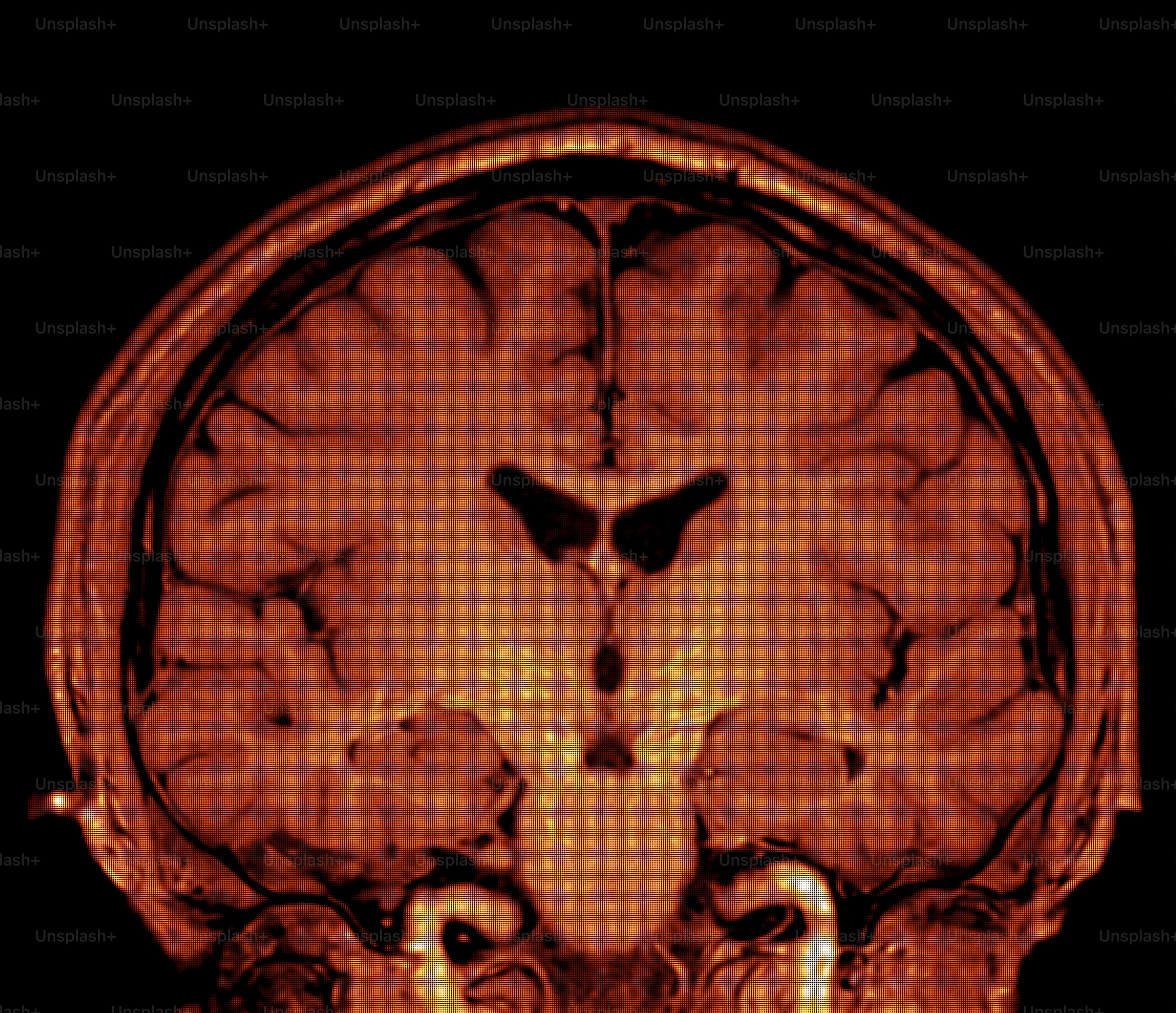 Four colorful mri scans of a human brain. photo – Health Image on Unsplash