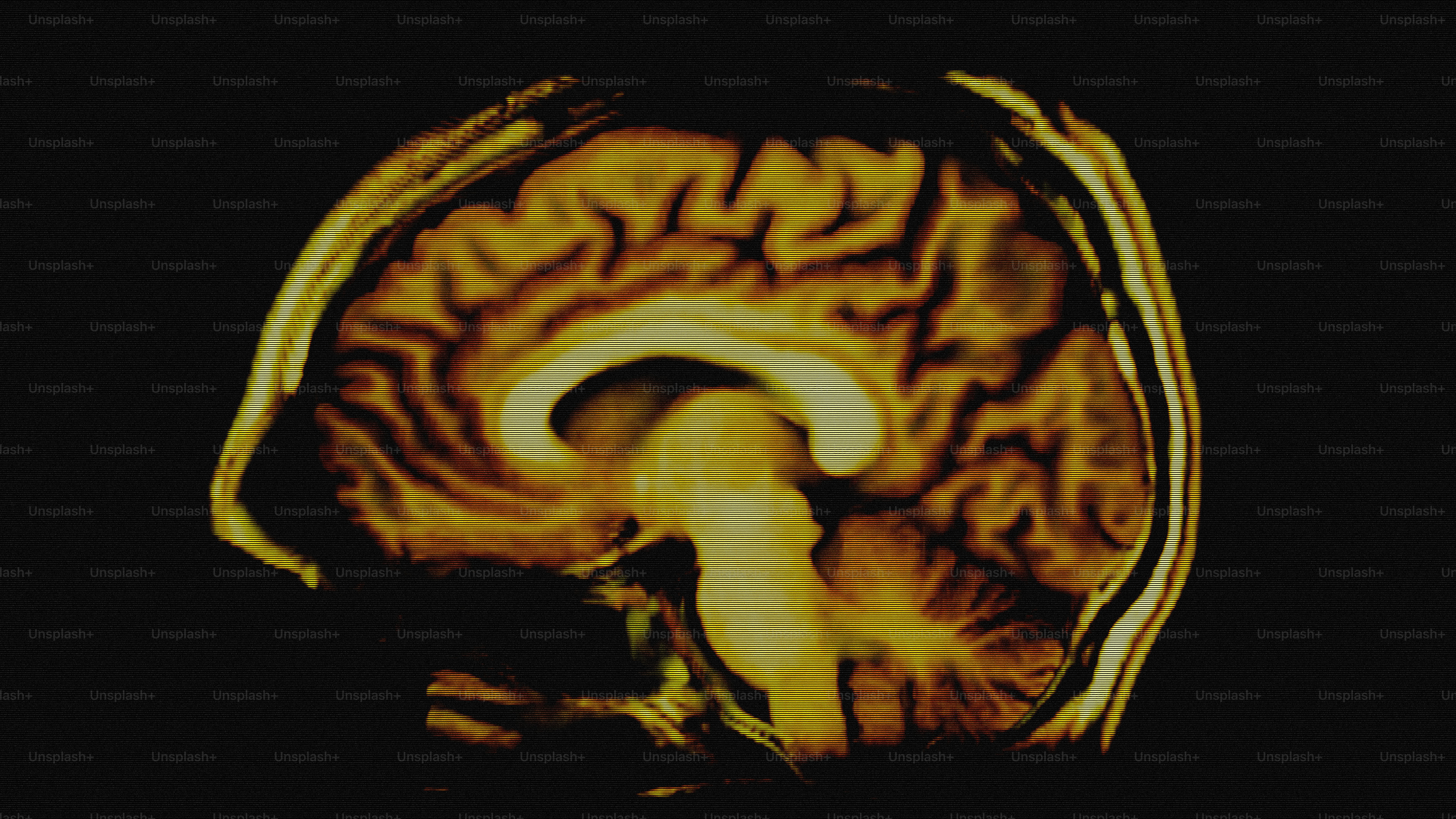 A colorful mri scan of a human brain. photo – Health Image on Unsplash